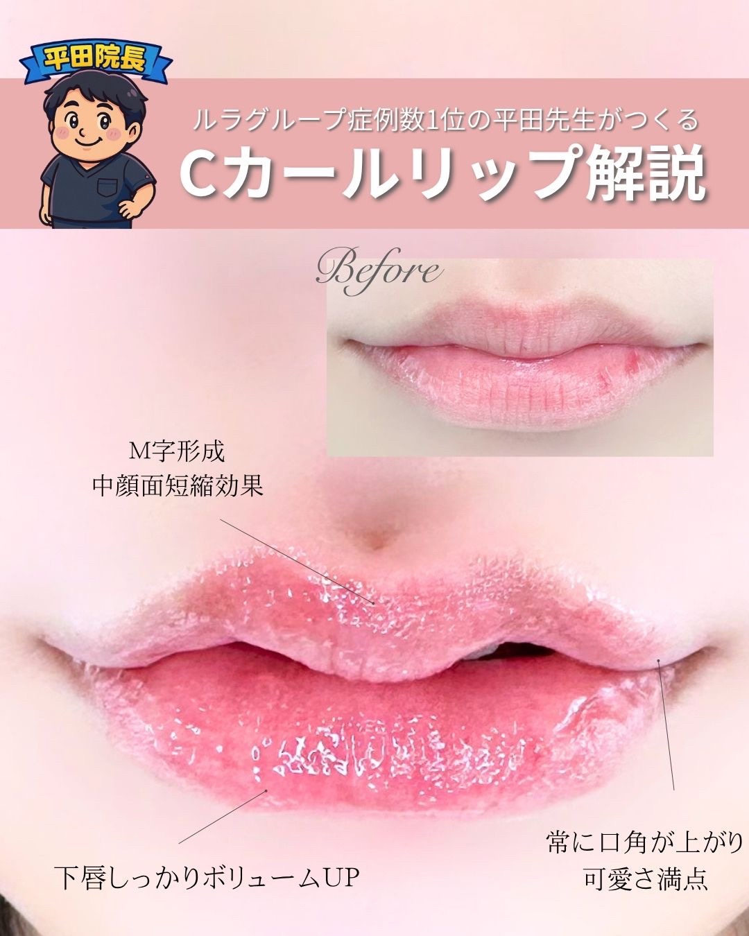 @ルラ美容クリニック大阪本院