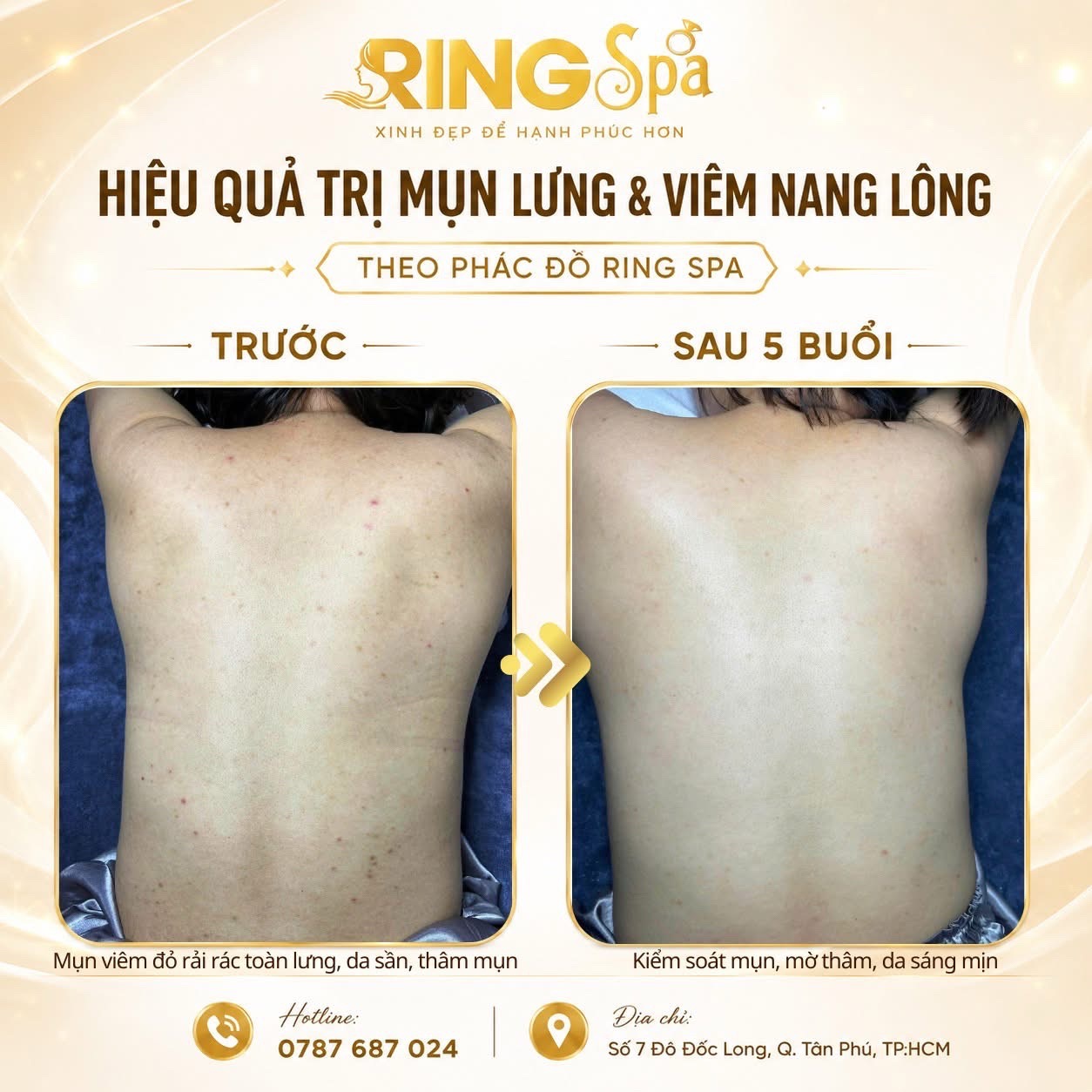 @Ring_Spa