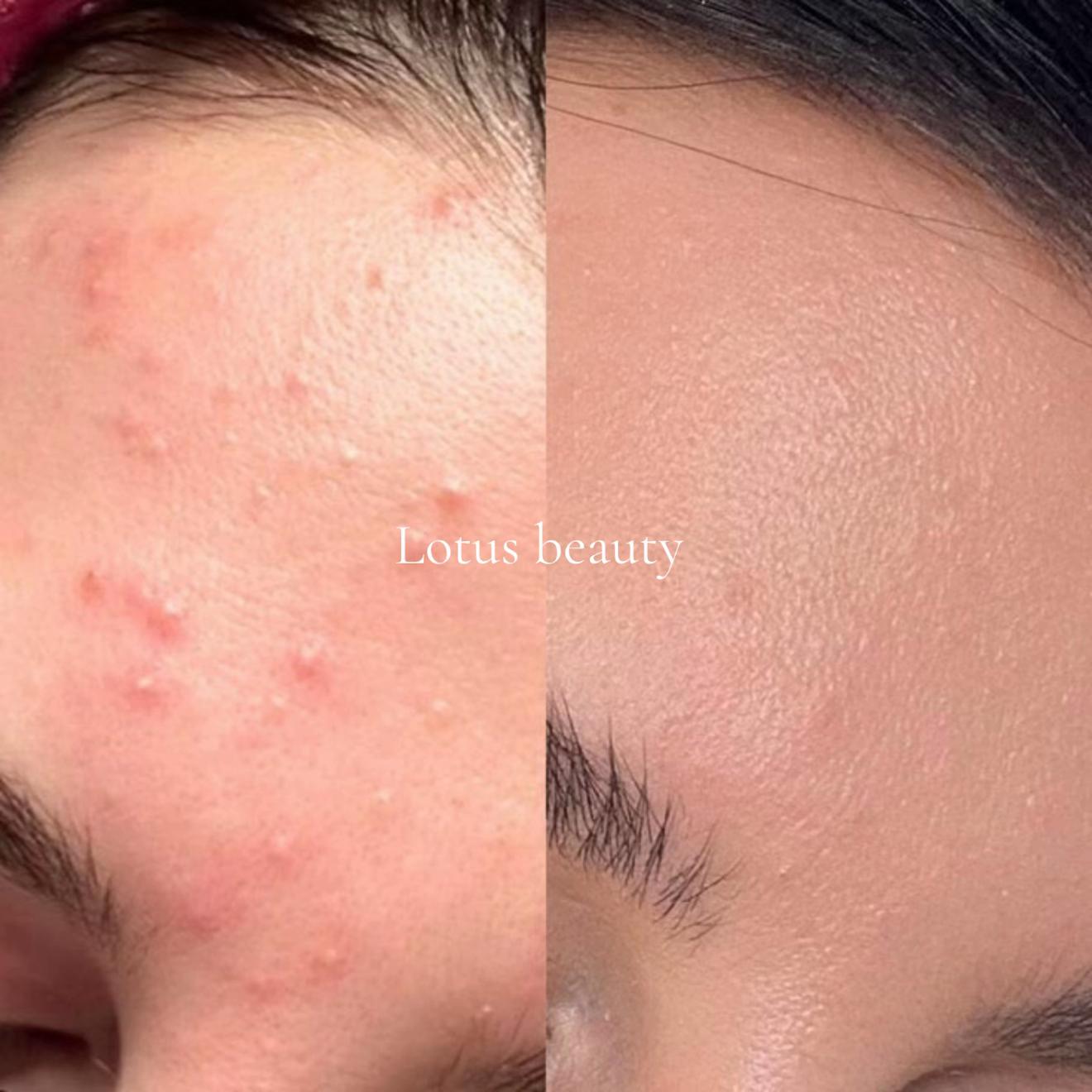 @Lotus Beauty Product PVT LTD
