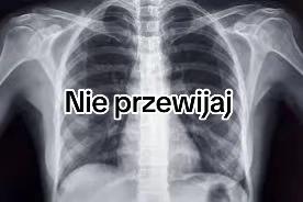 @Ratujemy