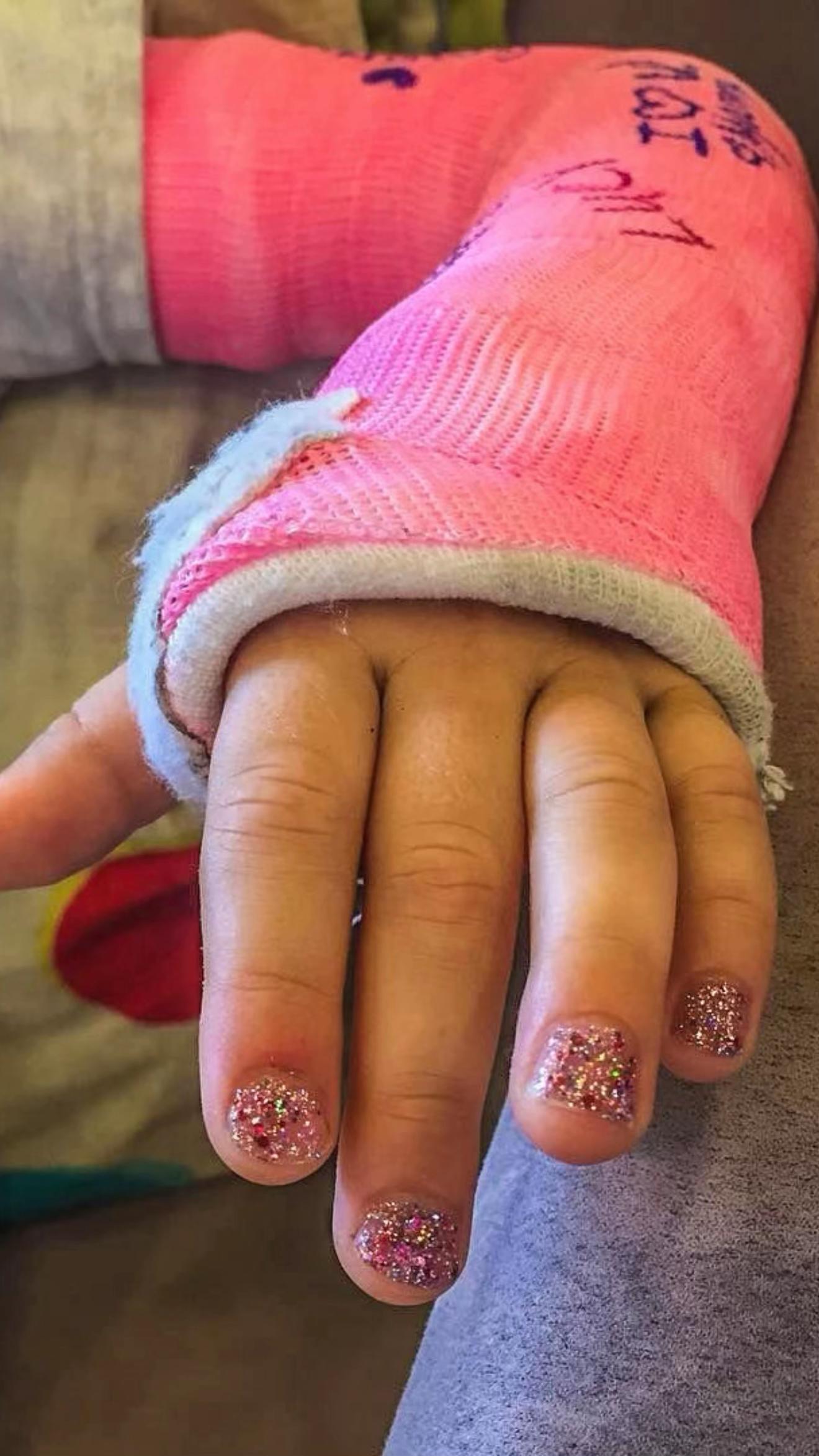 @Gips Fetish