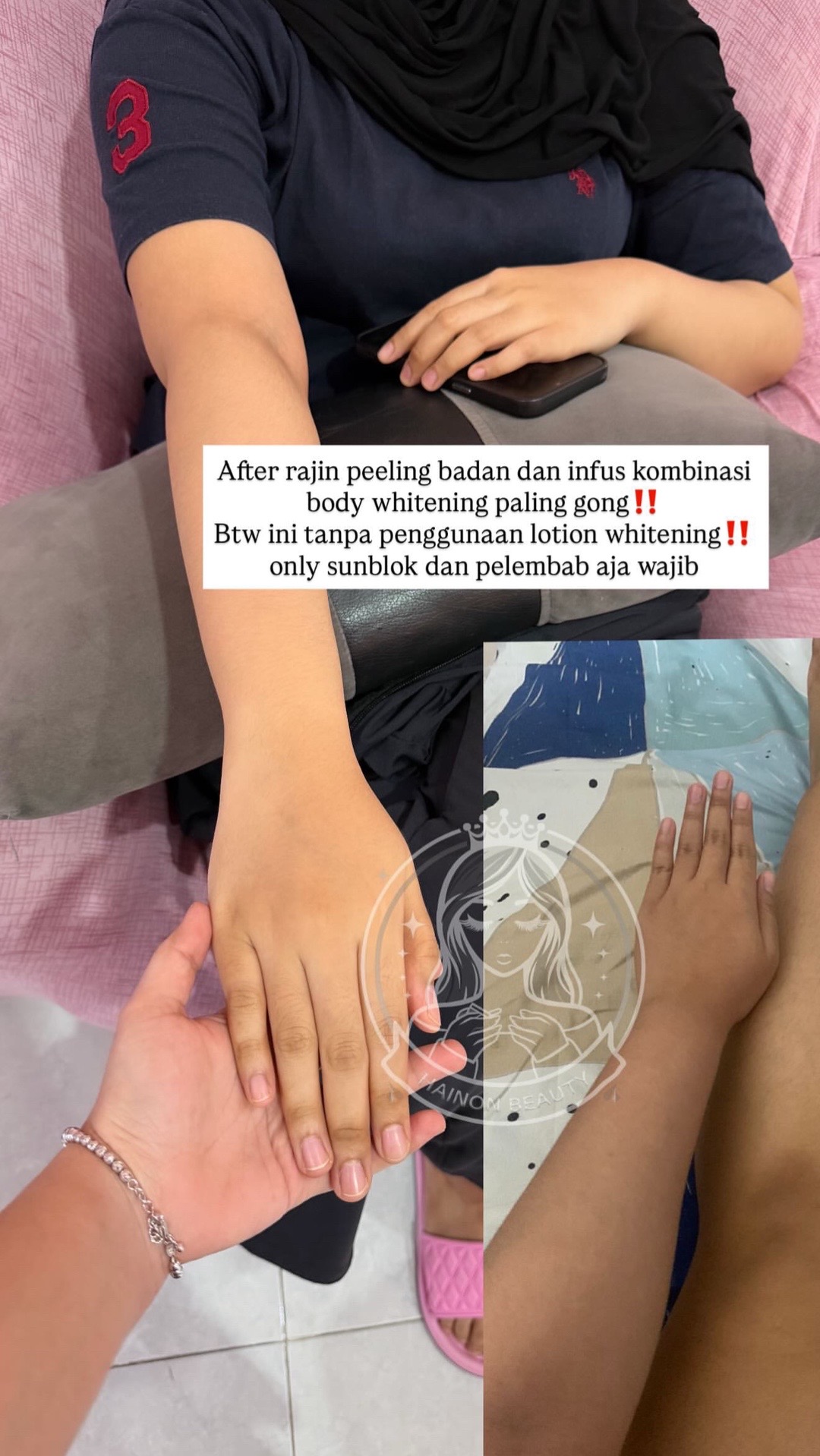 @Hainon Infus Whitening