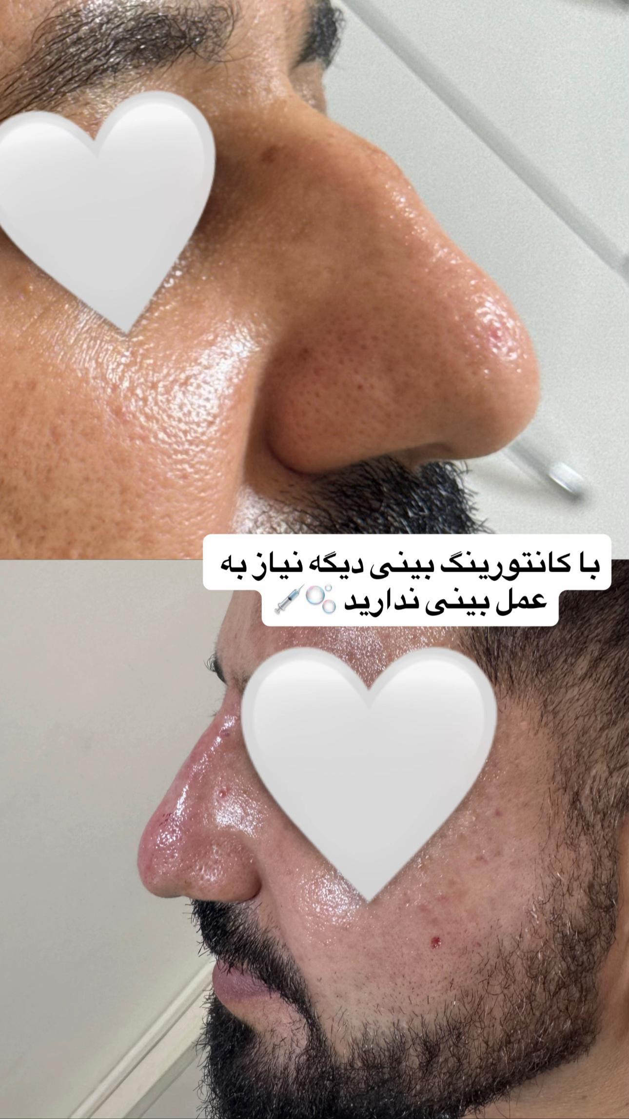 @Nazila beauty Clinic🇬🇧