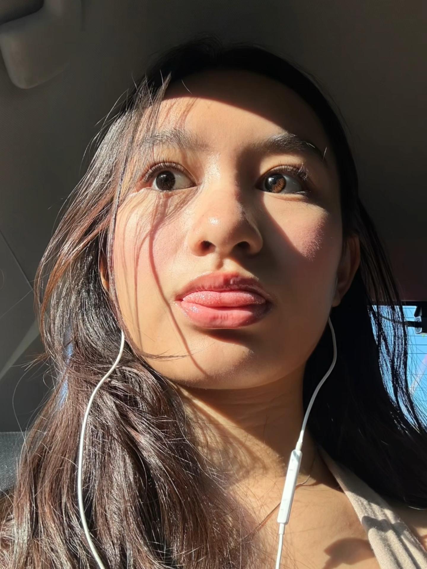 @hermyoneh