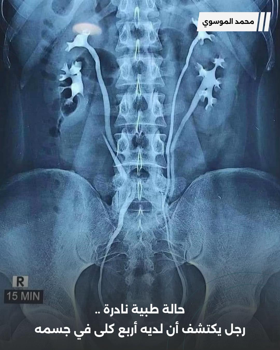 @محمد الموسوي