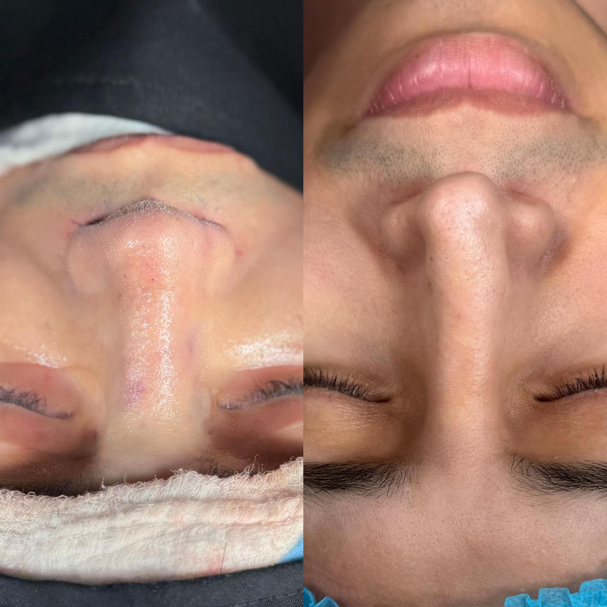 @Dr. Luis Vargas