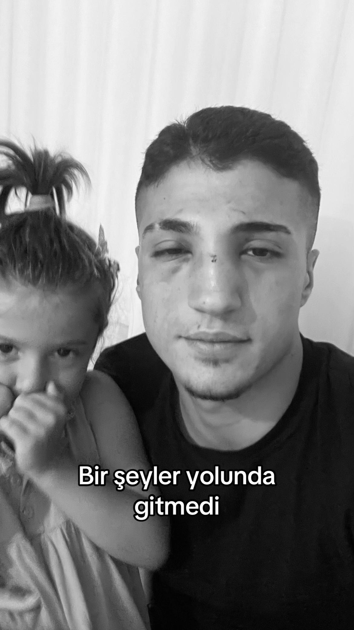 @koray_ogutt