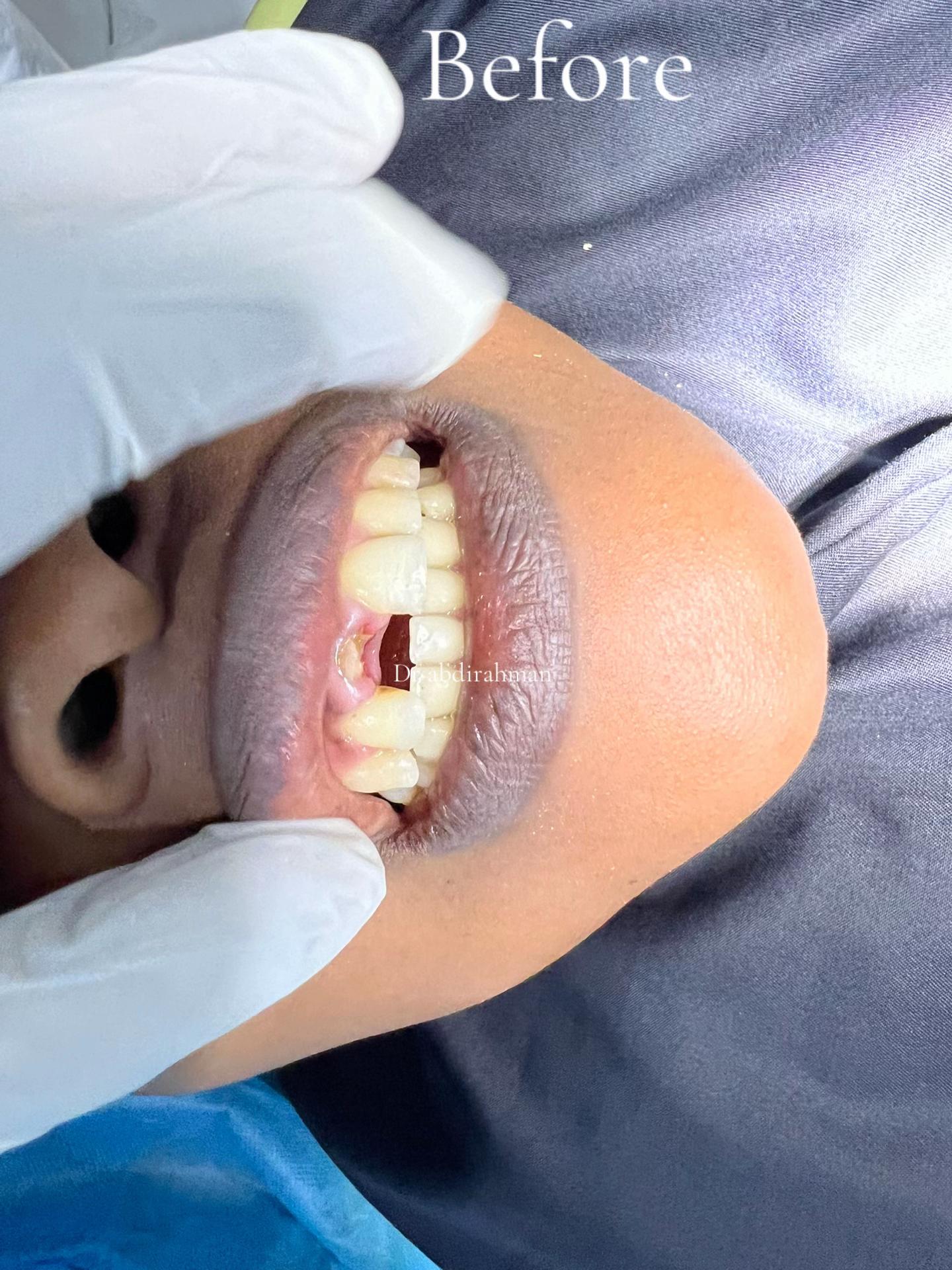 @Dr Abdirahman hassan laari