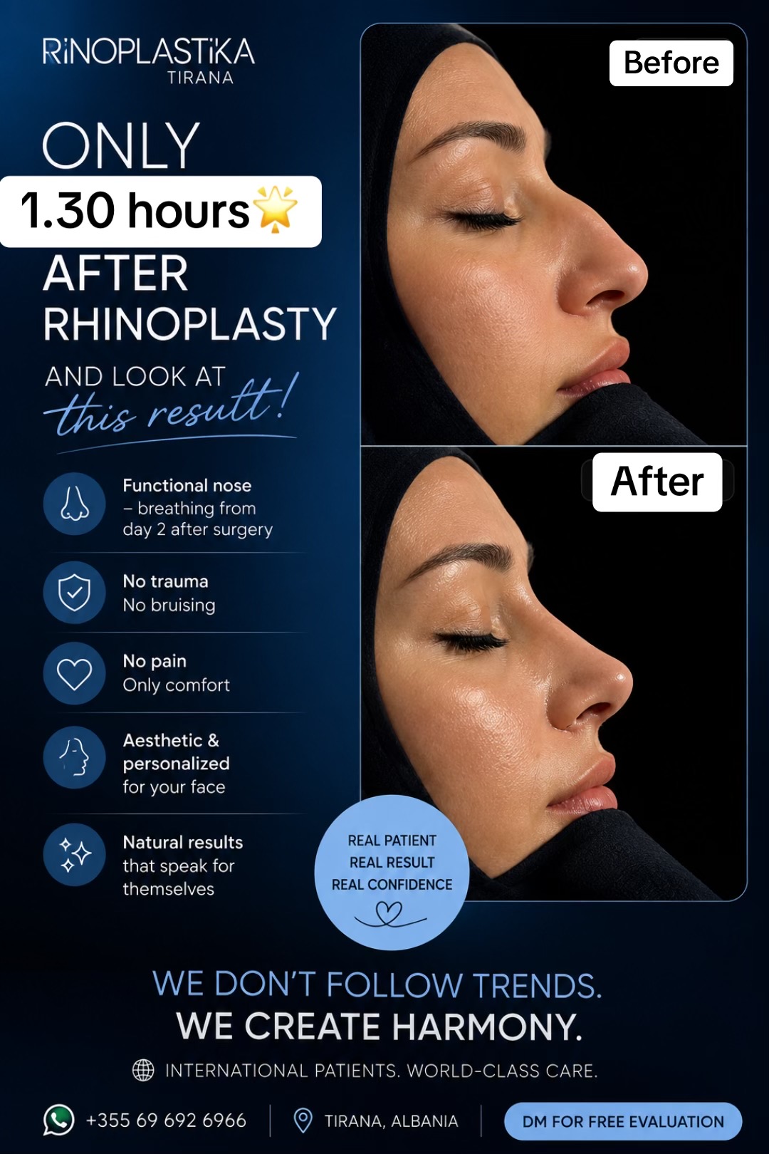 @rinoplasticatirana
