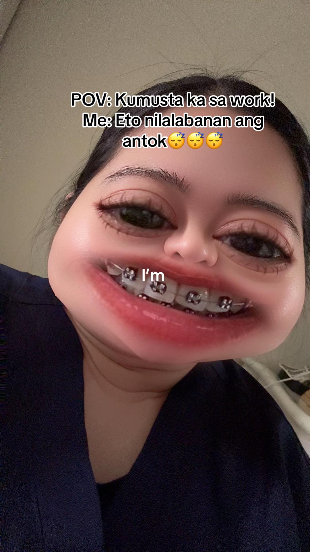 @edmaLyn03๐ ๐ฉบ