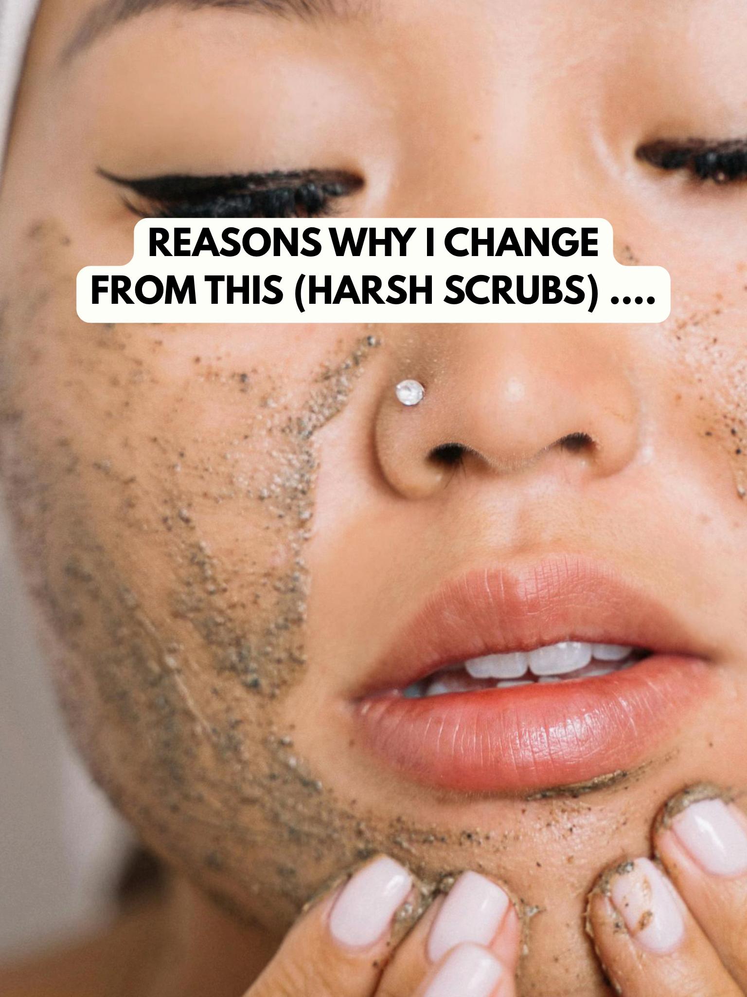 @Mervably Skin