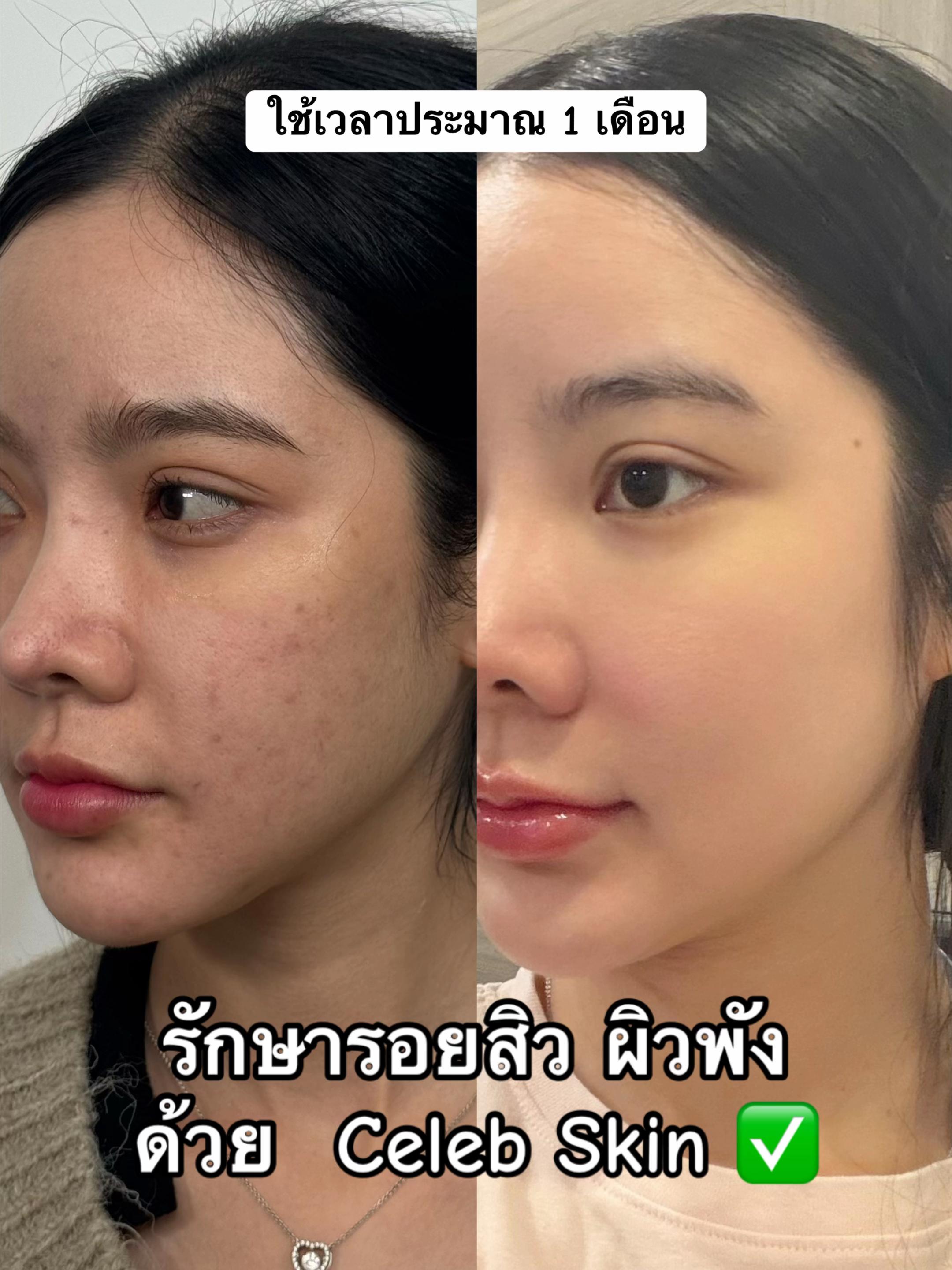 @APEXYOUNGCLINIC