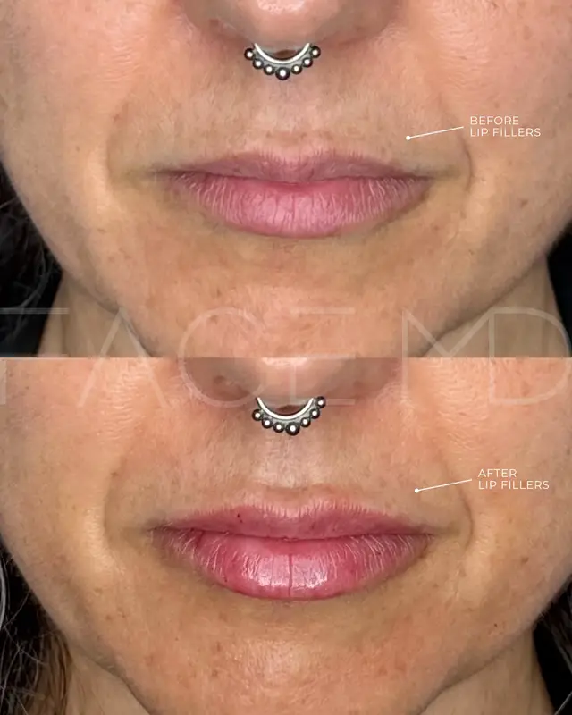 @cliniquefacemd