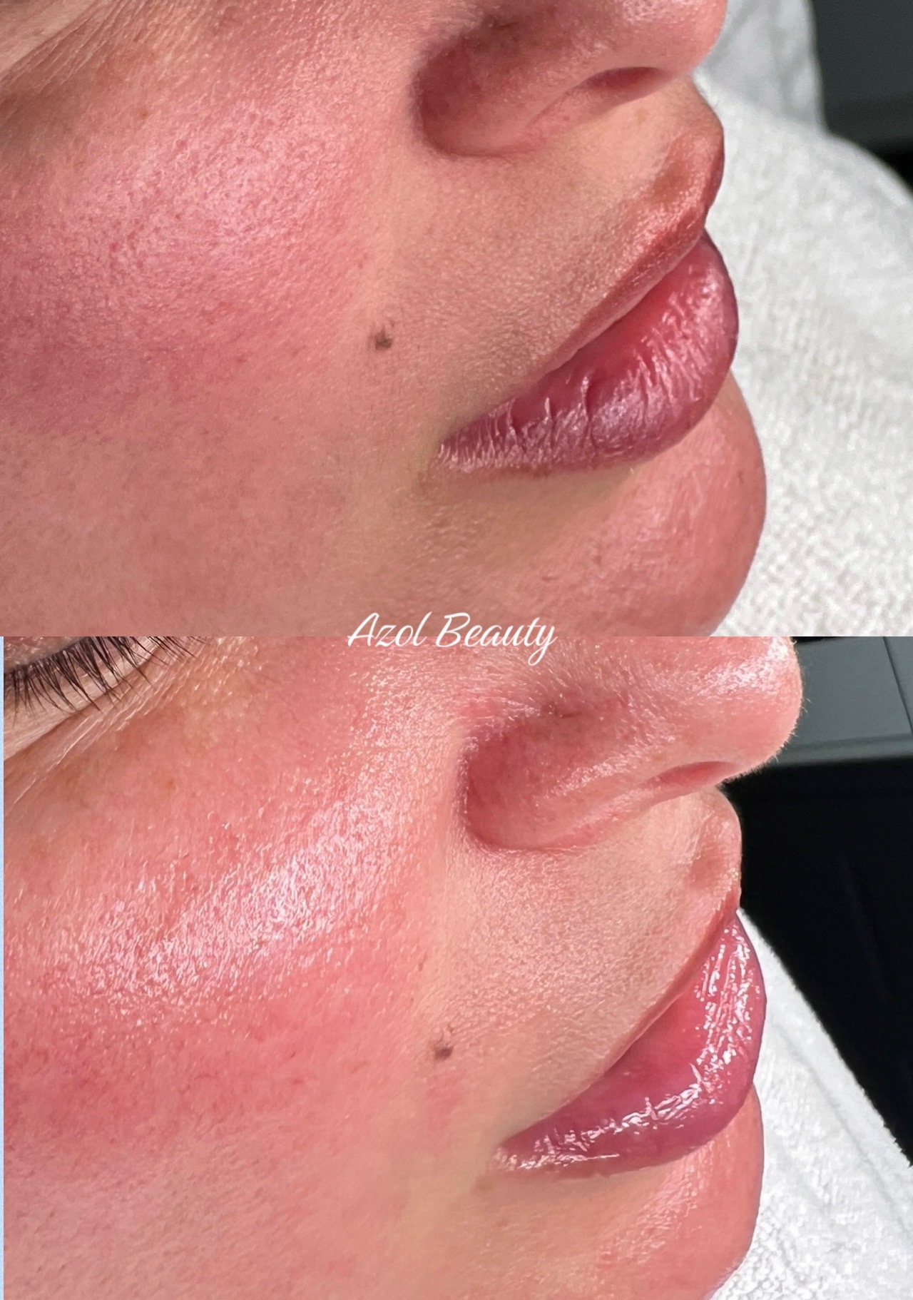 @Azol Beauty