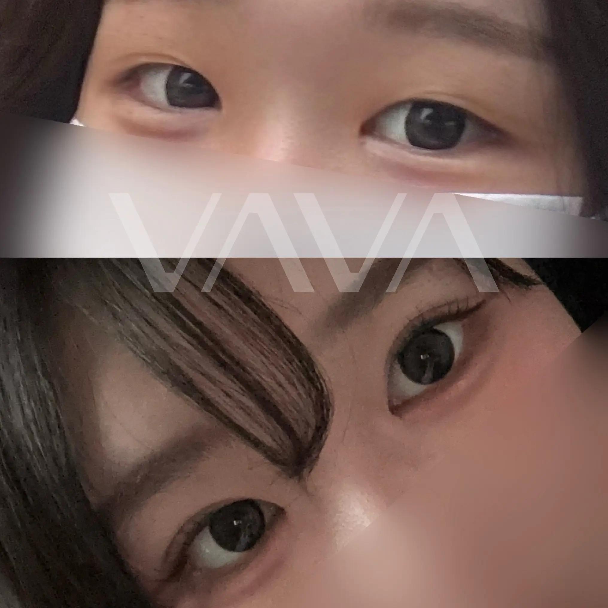 @VAVA美容整形外科