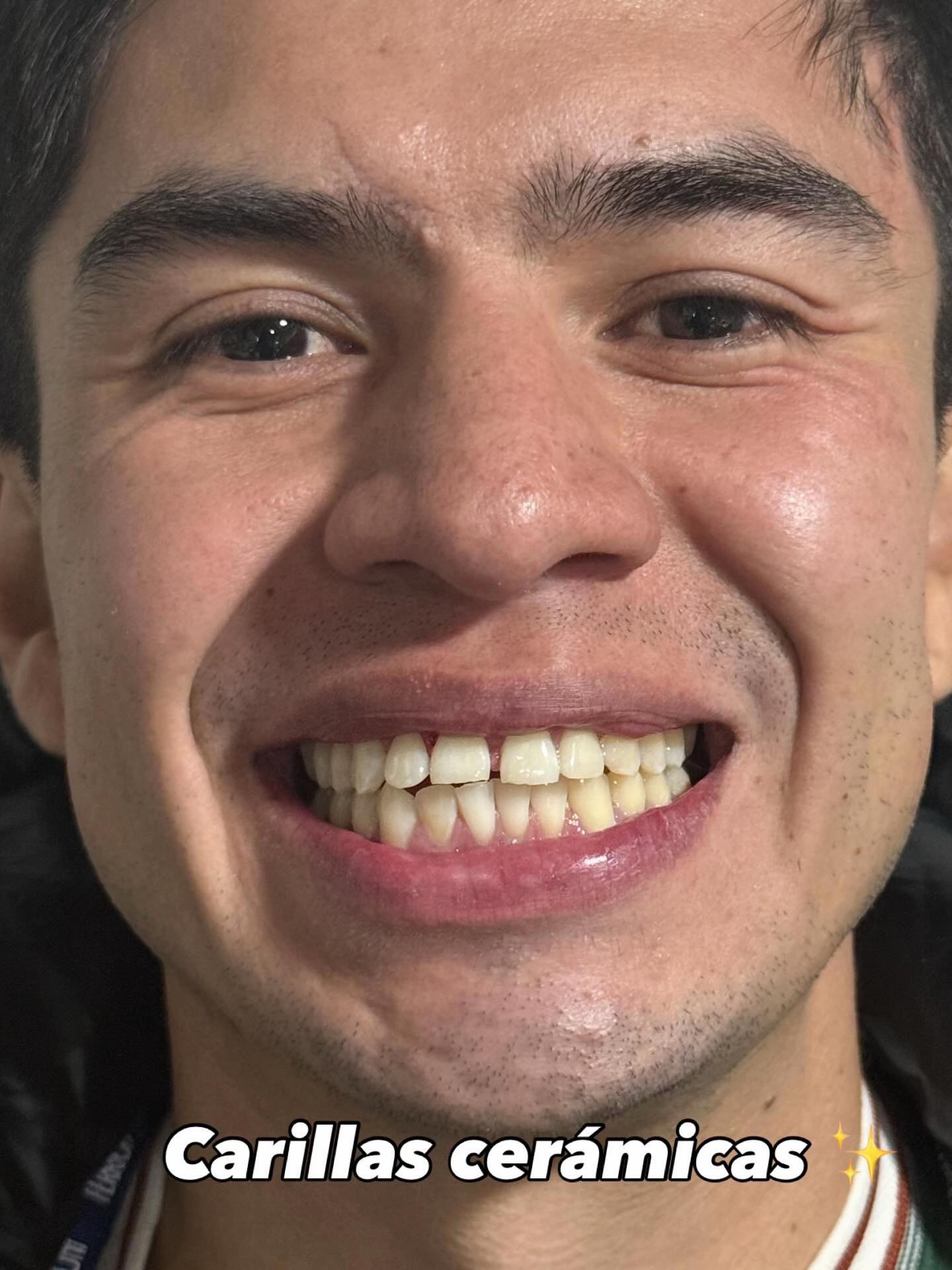 @GabeApreza