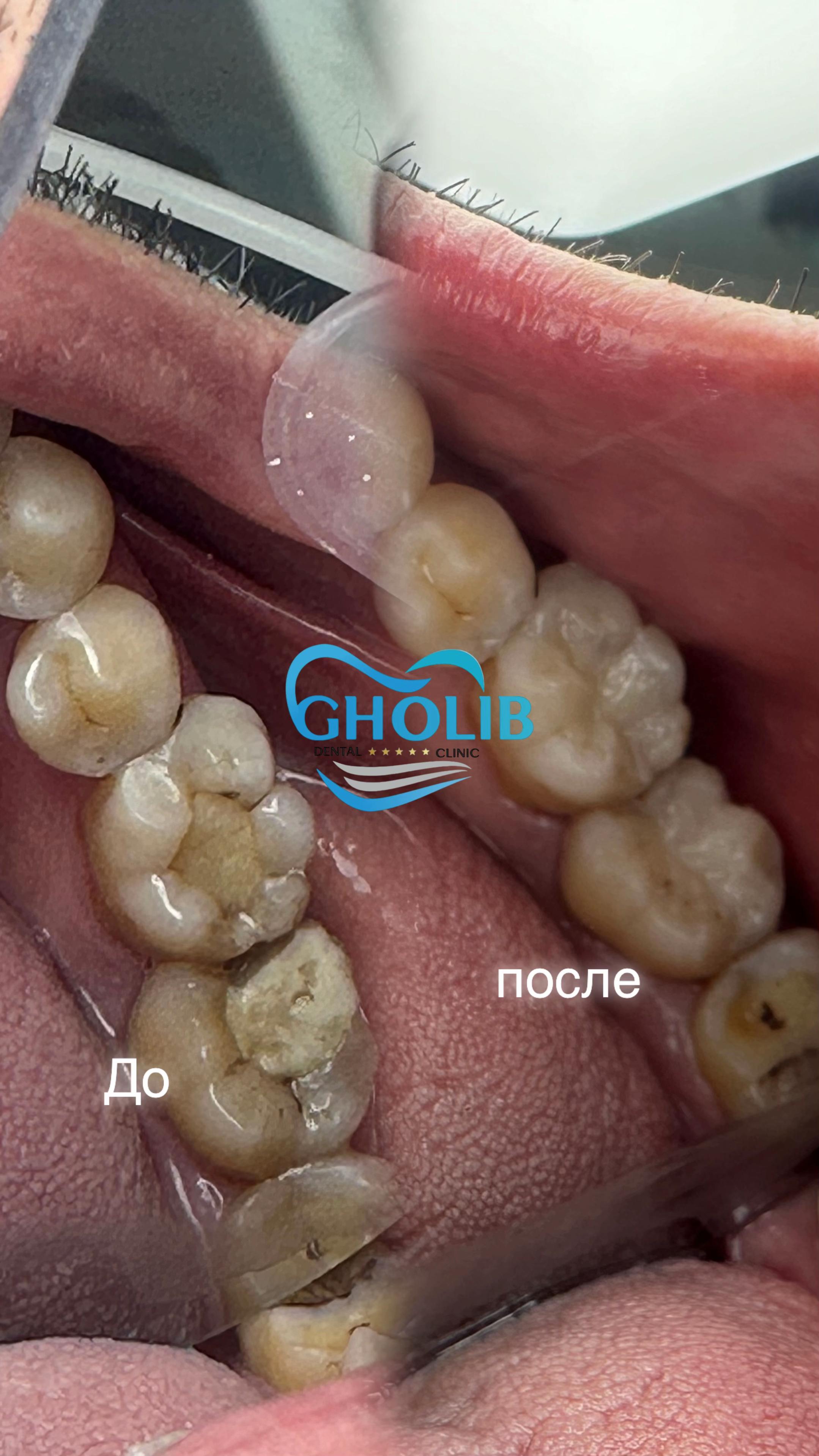 @dr_gholibshoh.stom