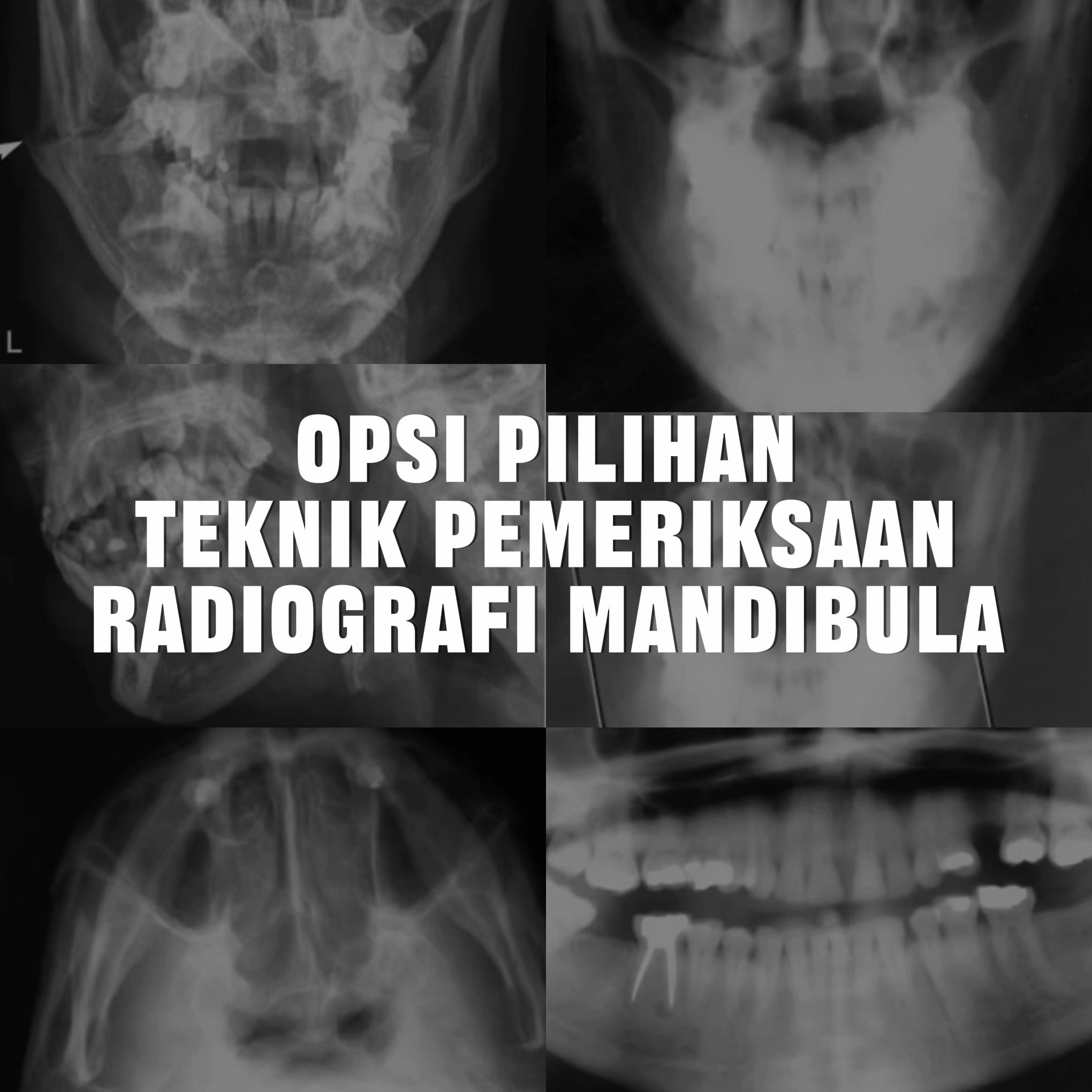 @Sobat Radiology