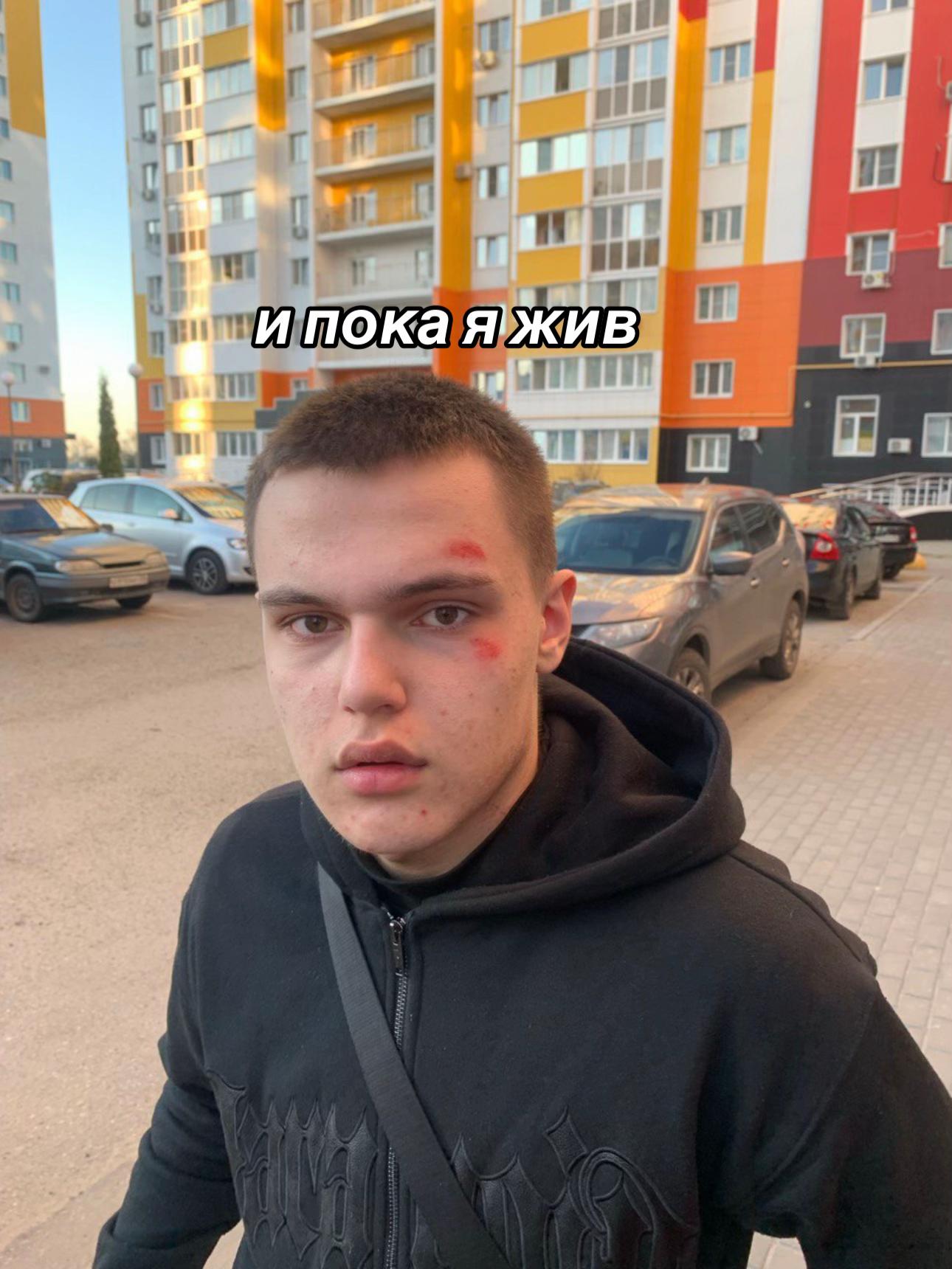@𝑨1𝒓𝒎𝒆𝒎𝒑𝒍🌚