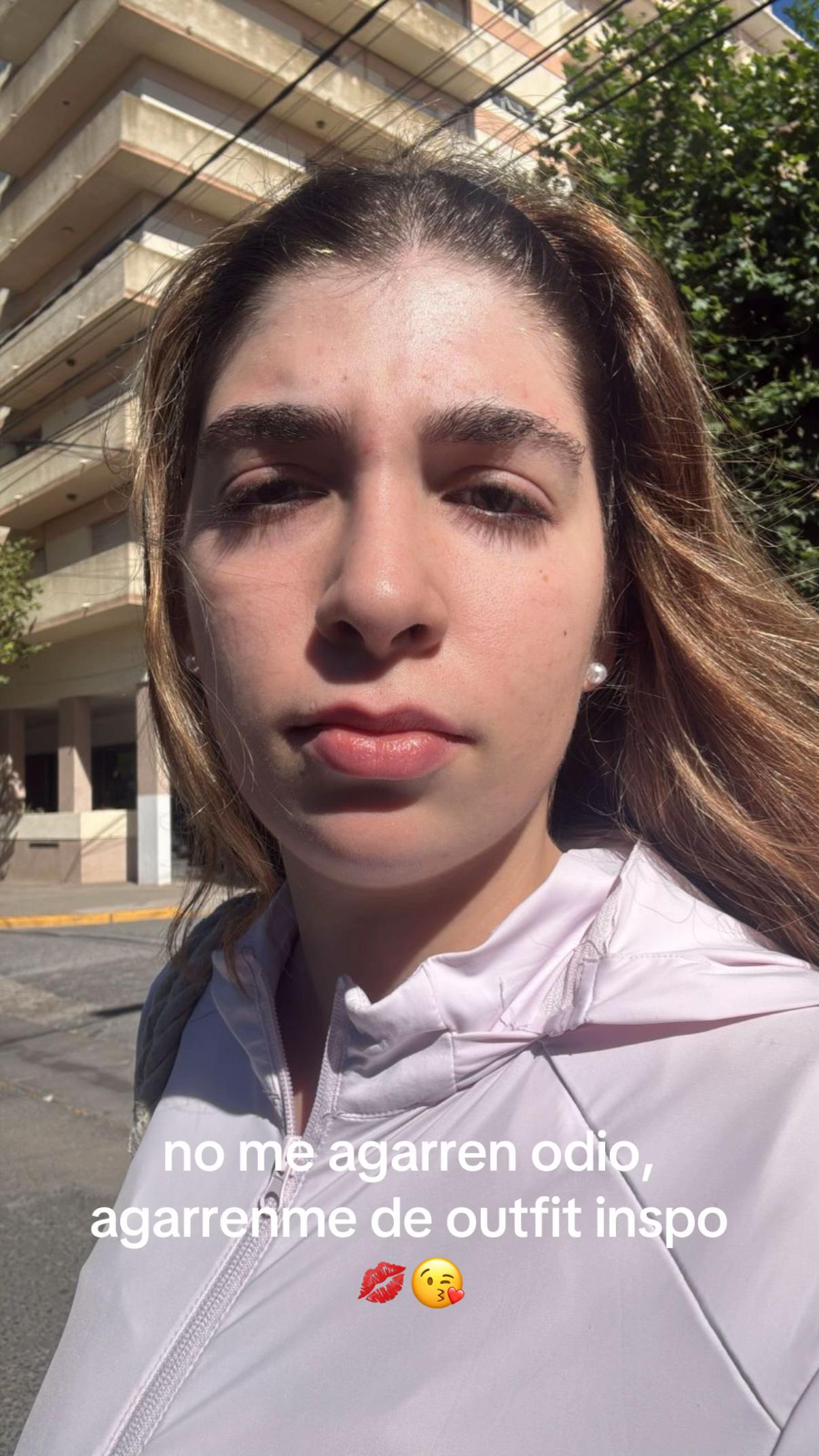 @Lucero