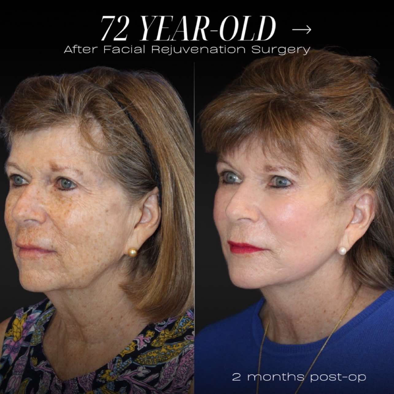 @Dr. Maia | Plastic Surgeon