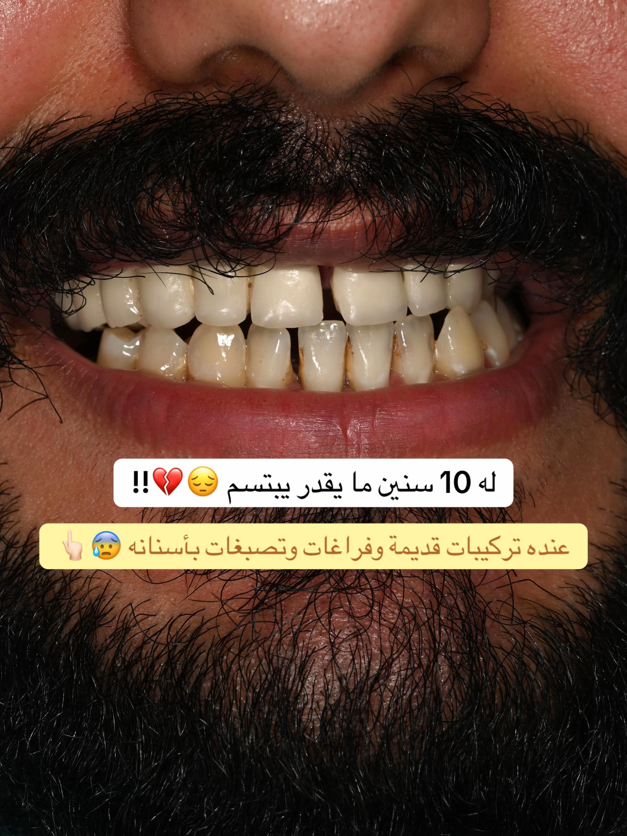 @Dr.lina_almasmoum