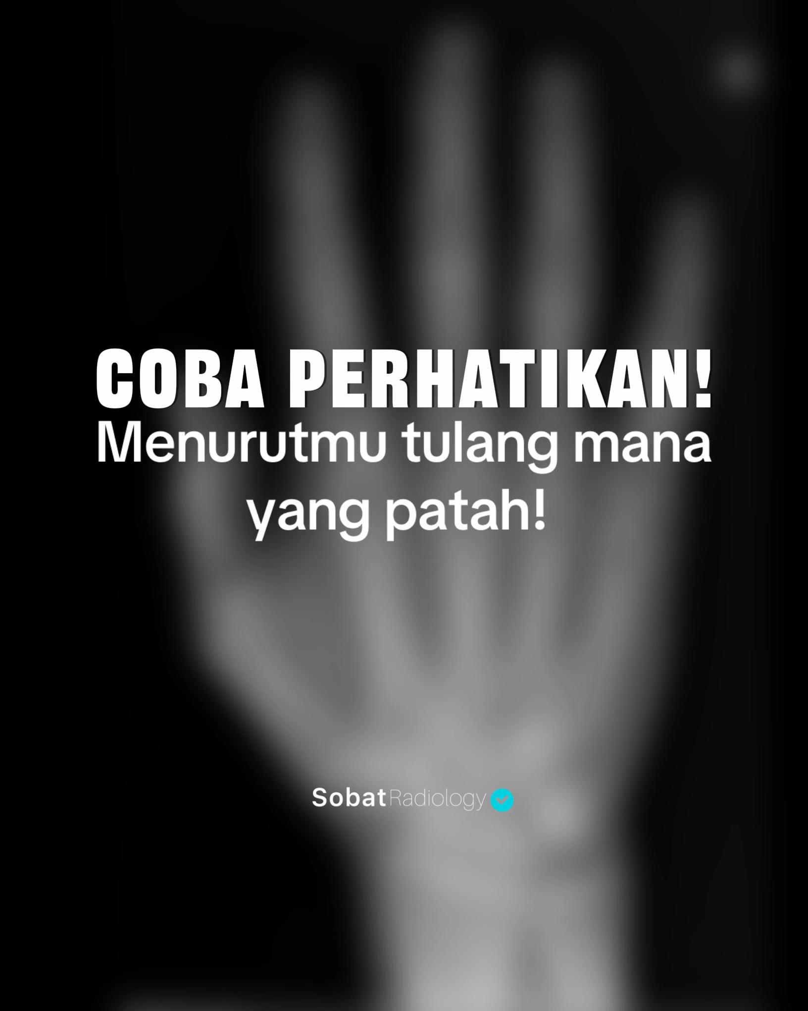 @Sobat Radiology