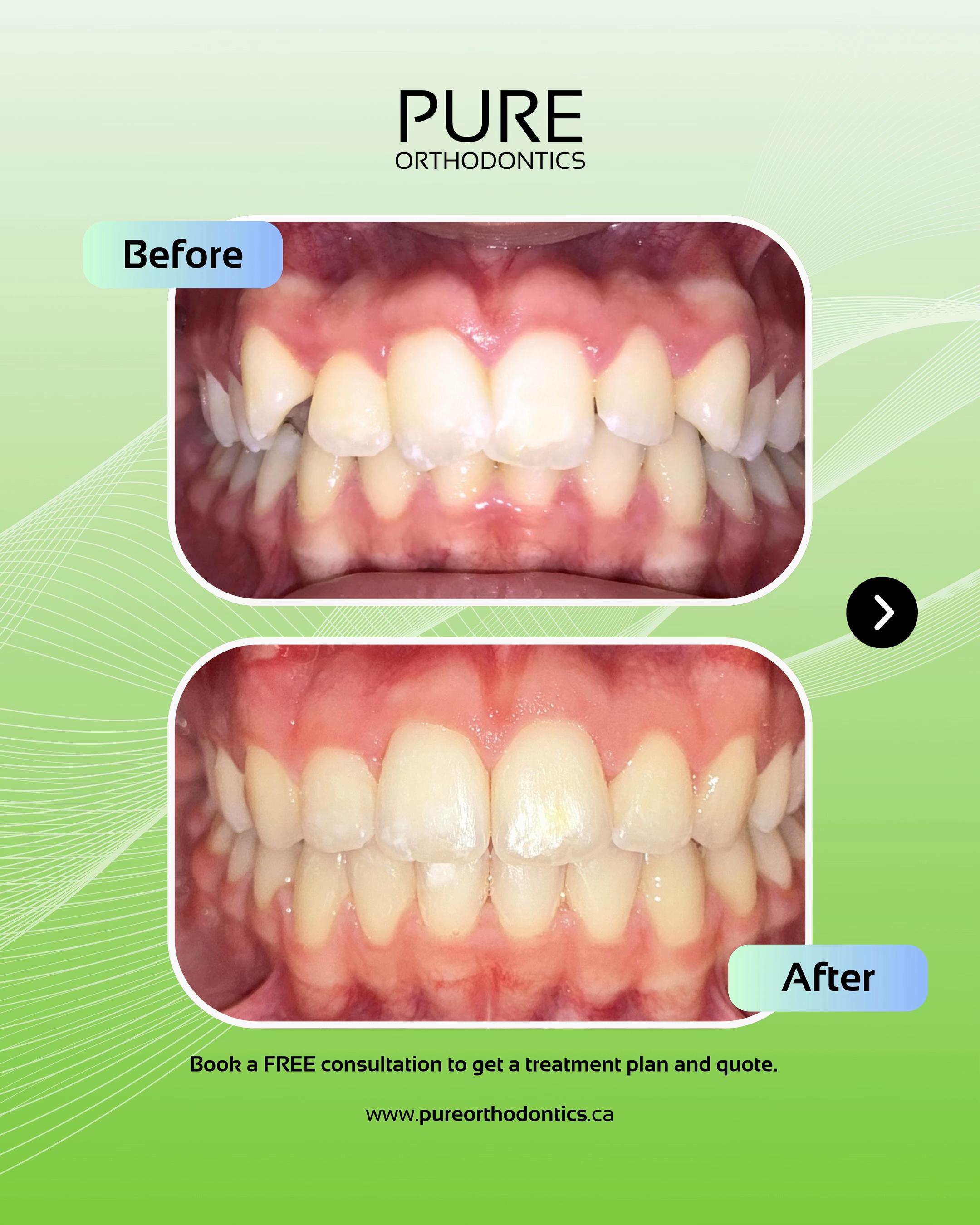 @Pure Orthodontics