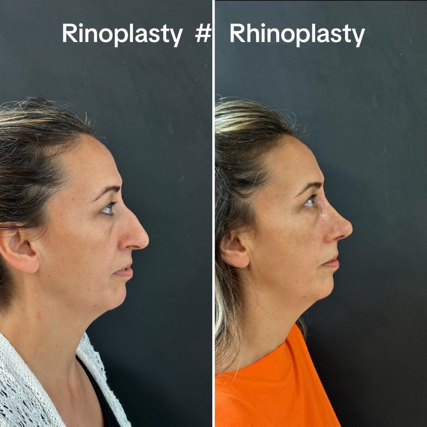 @Dr. NurtenKucuk