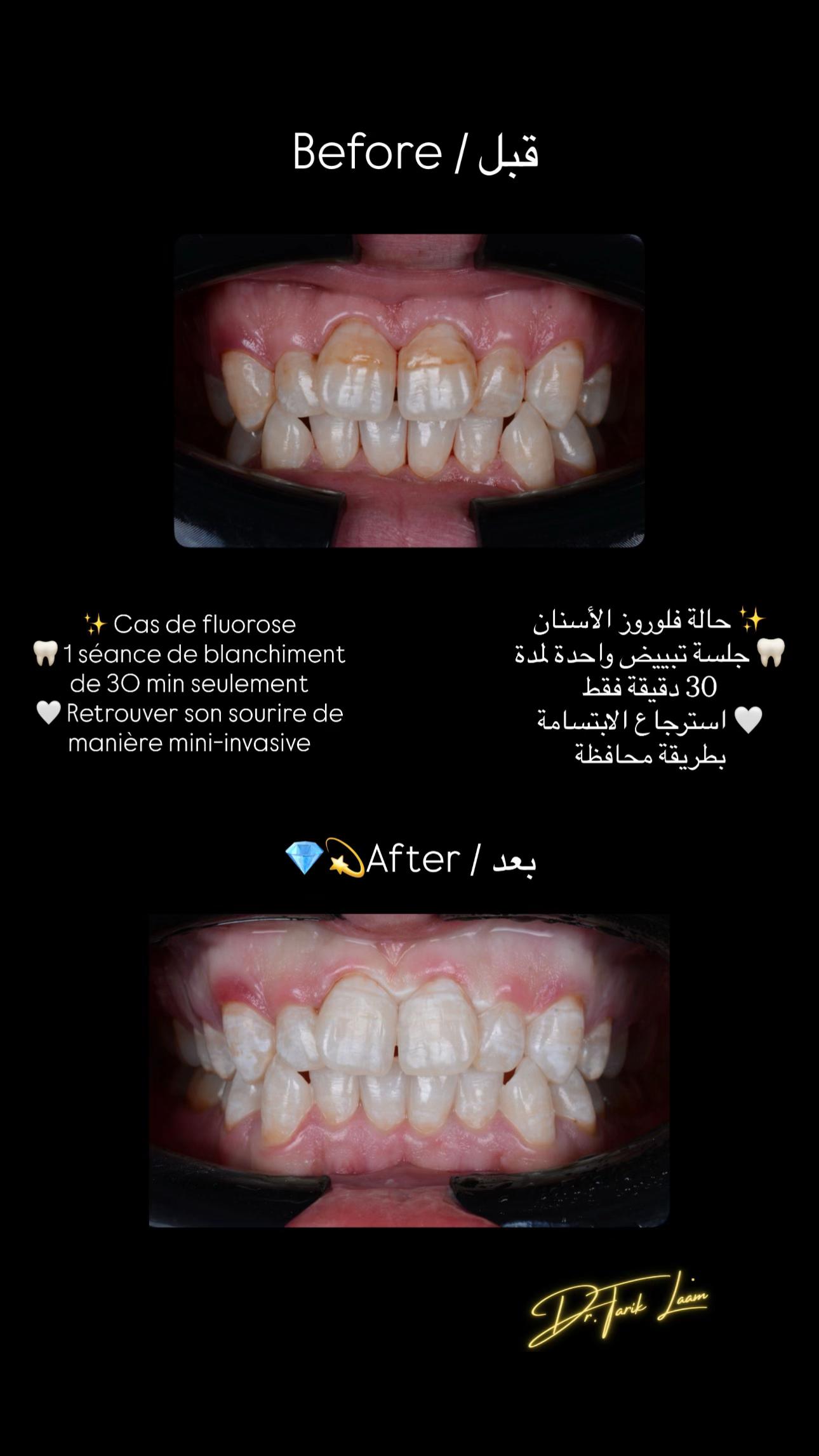 @Dr.tarik_laam