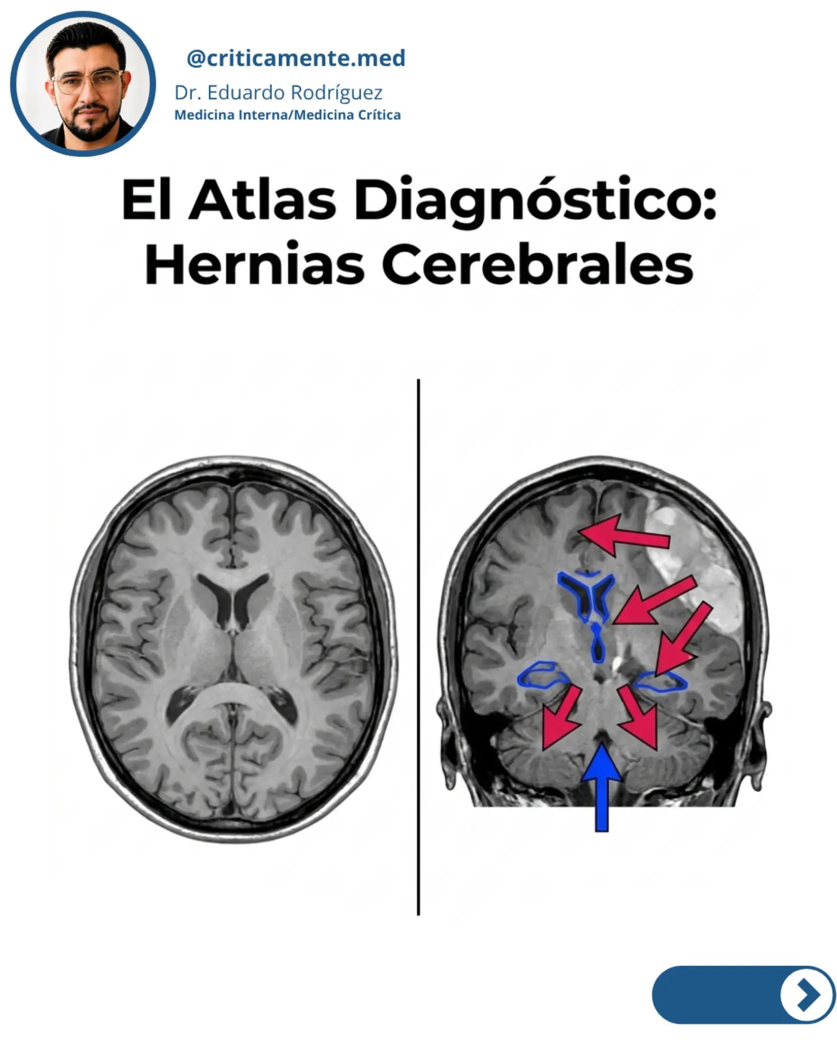 @Criticamente