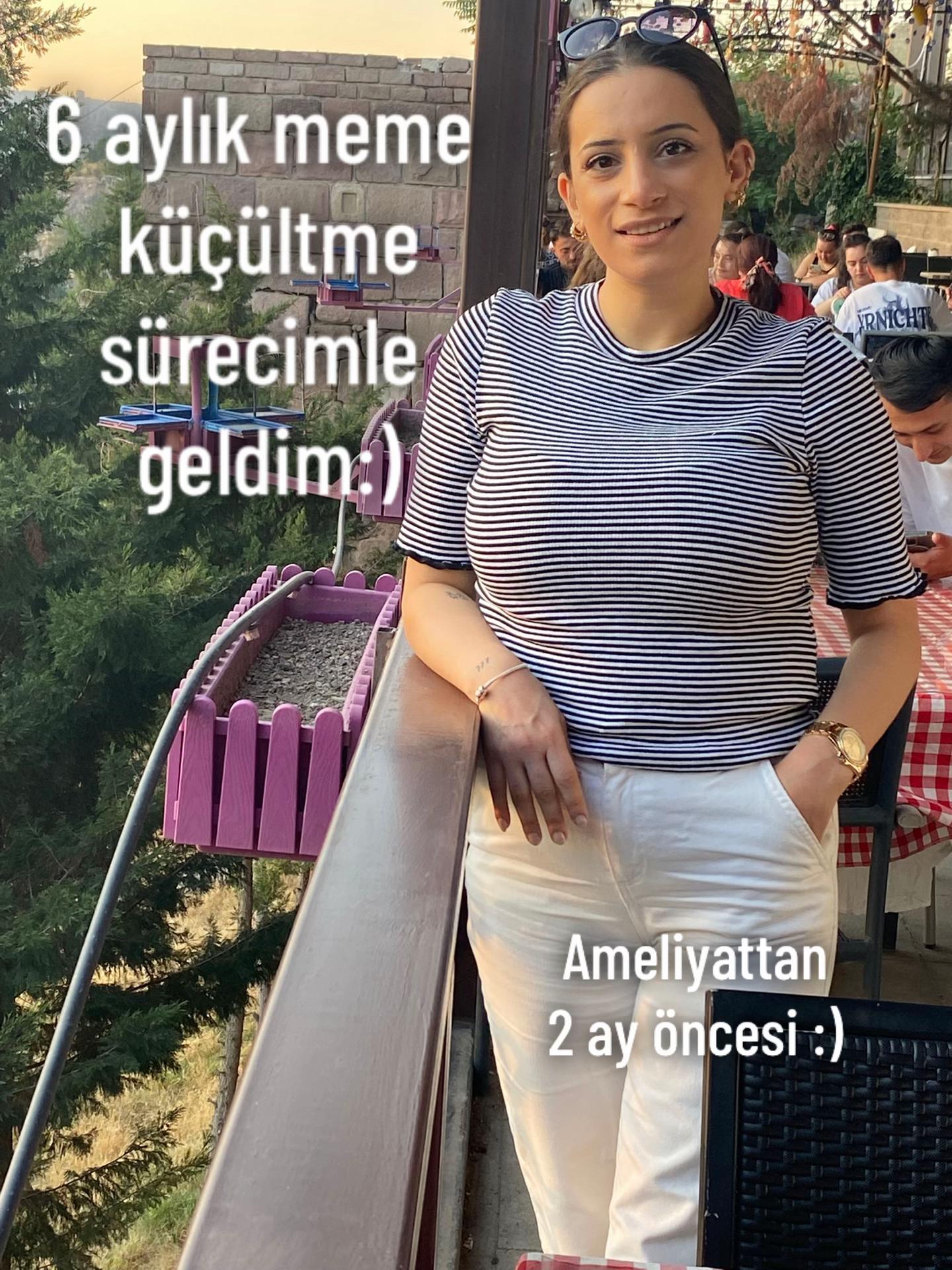 @Yasemin Tanır