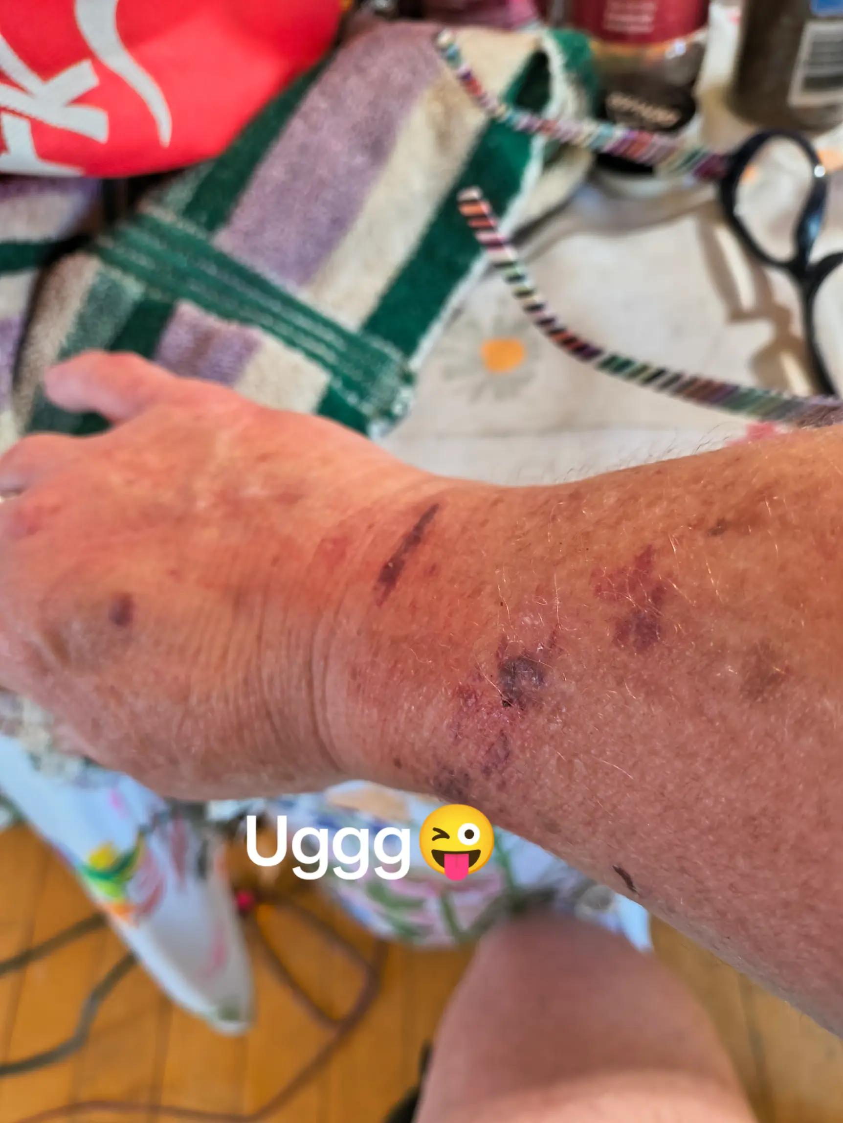 @BarbaraGen❌♿