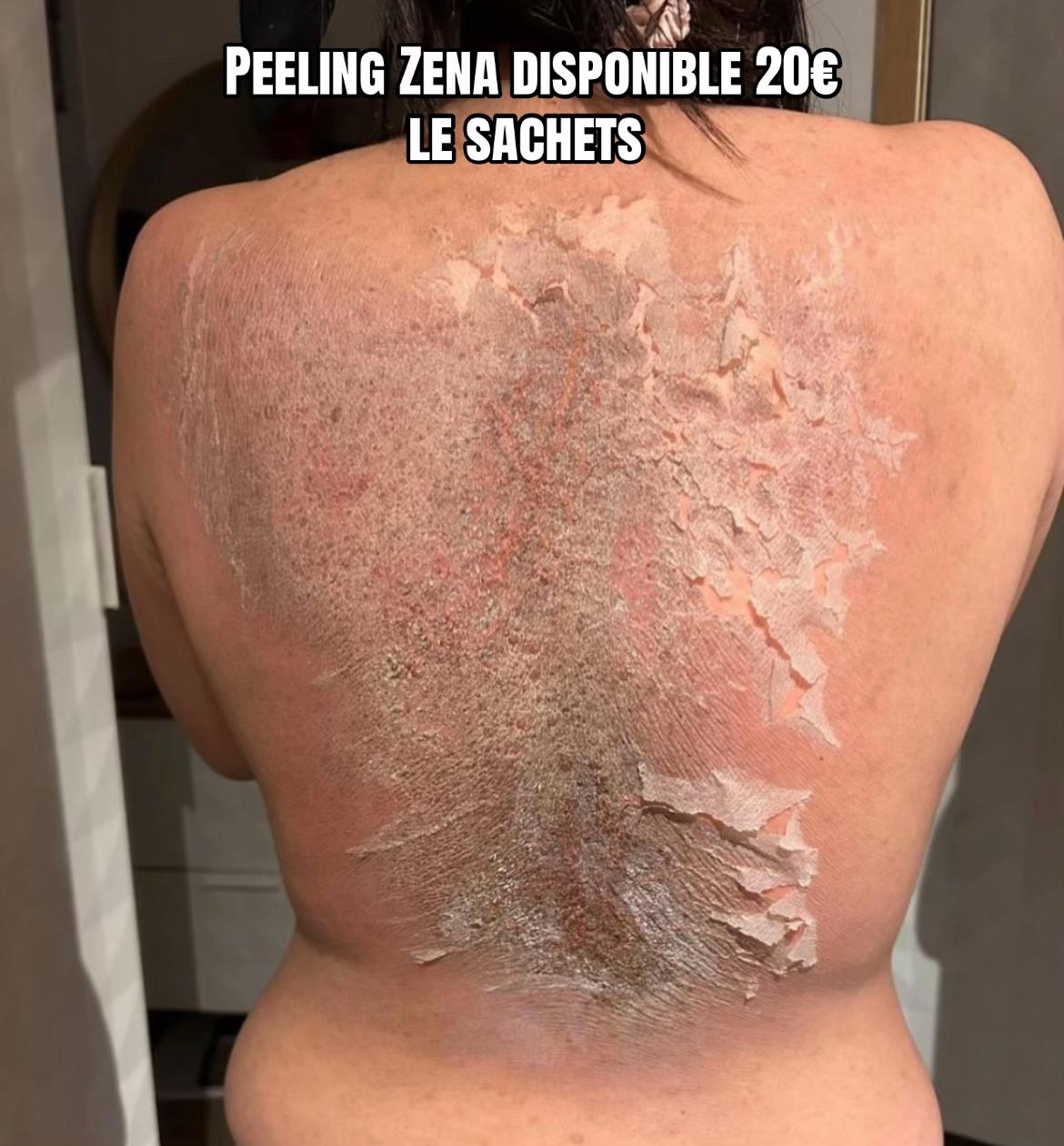@peeling_zena