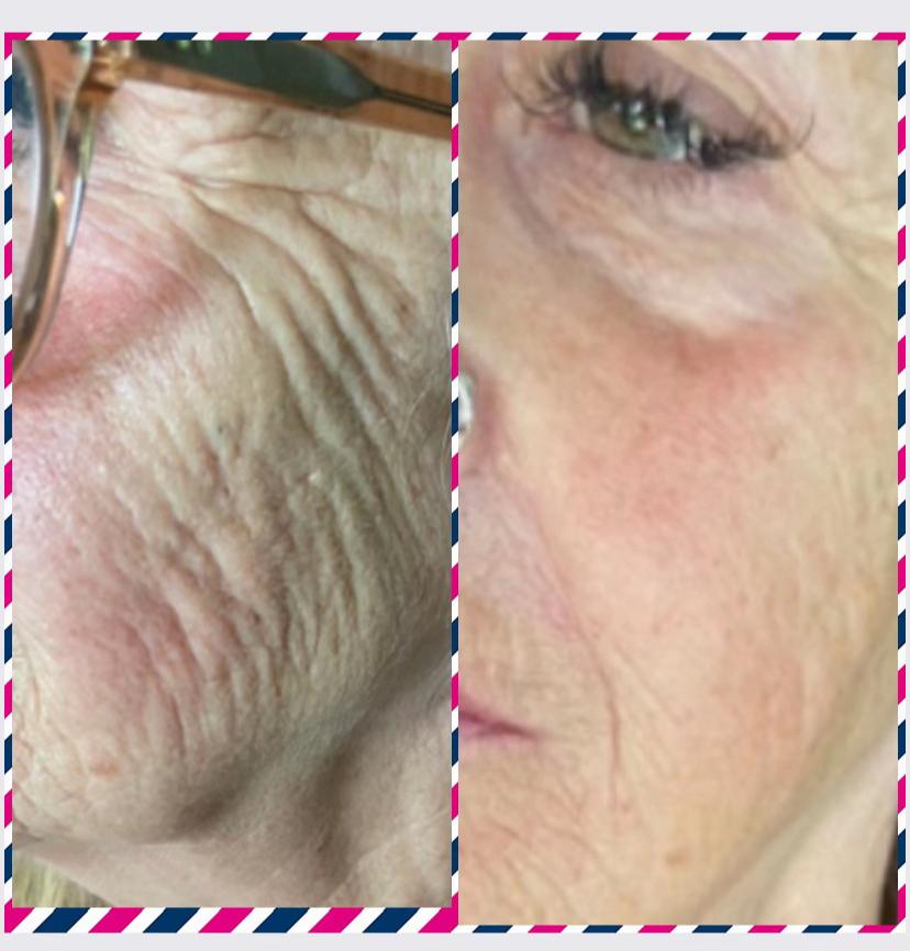 @Diamond Aesthetics Barnsley