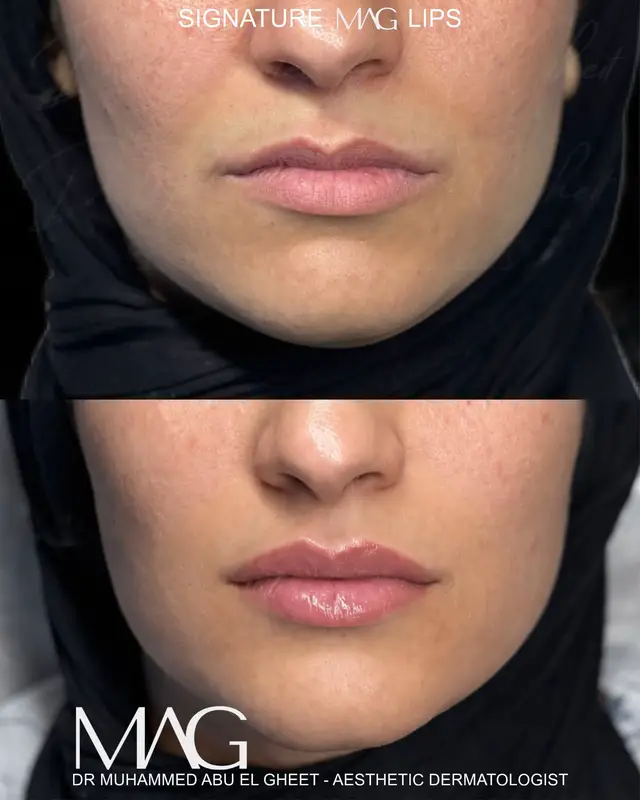 @Dr. Mohamed Abu El-Gheet