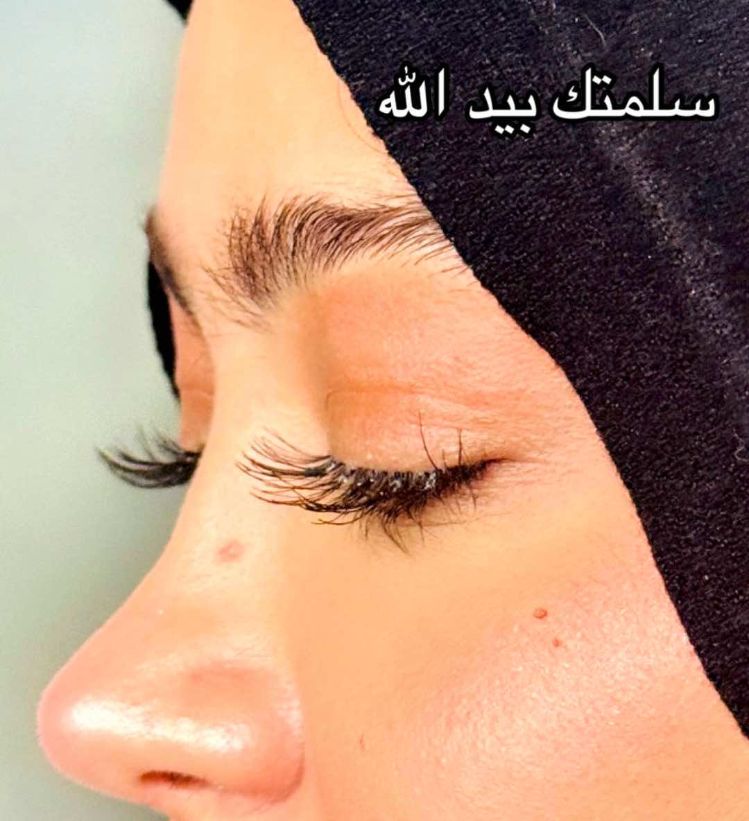 @Amal katkout