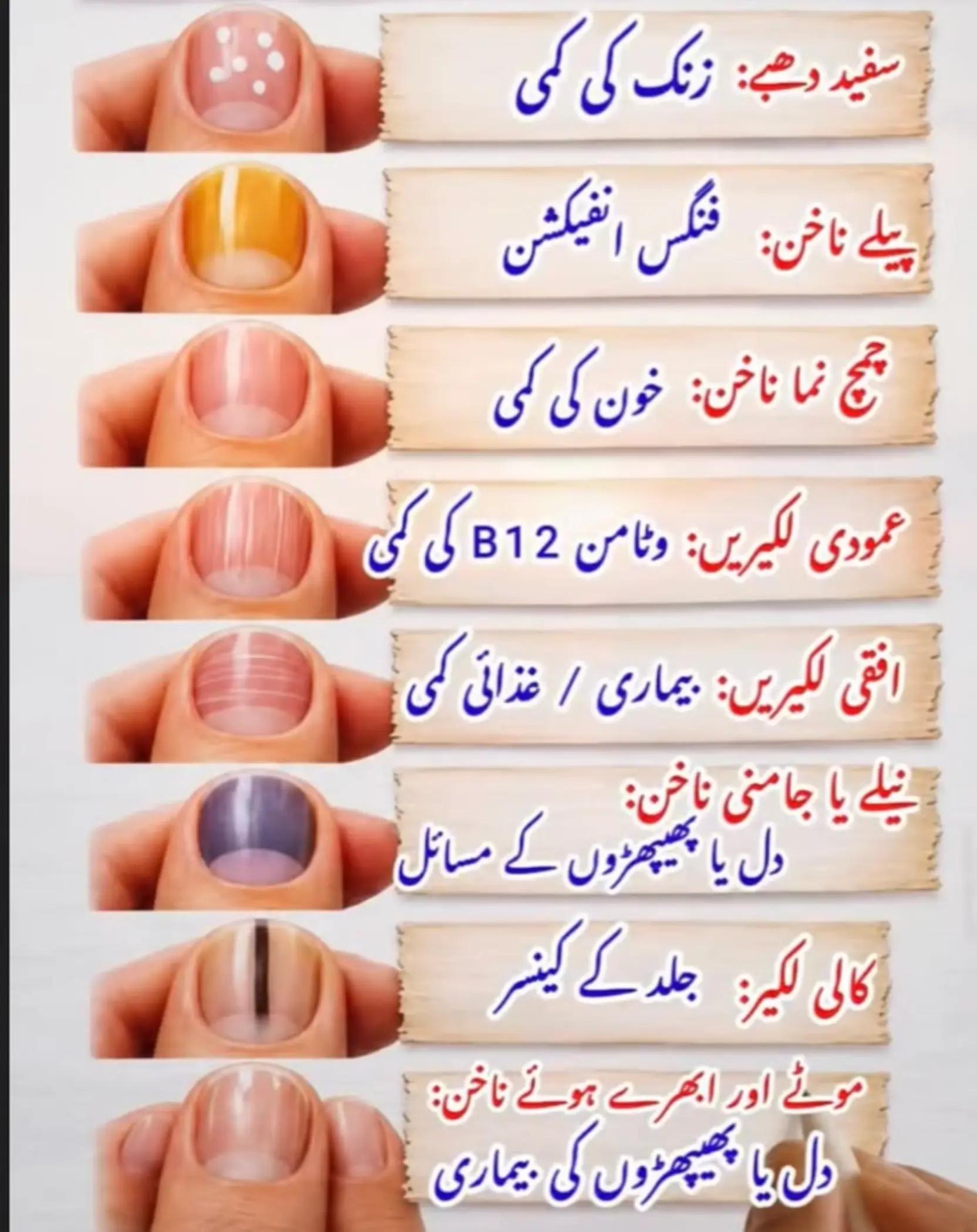 @Mishi Khan
