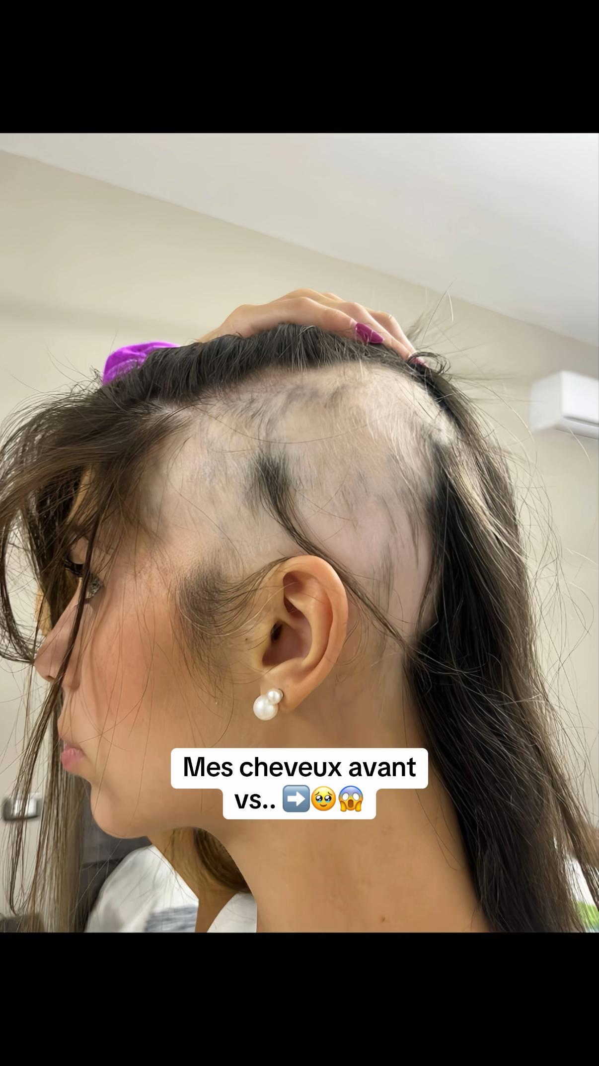 @Lux’Hair Growth