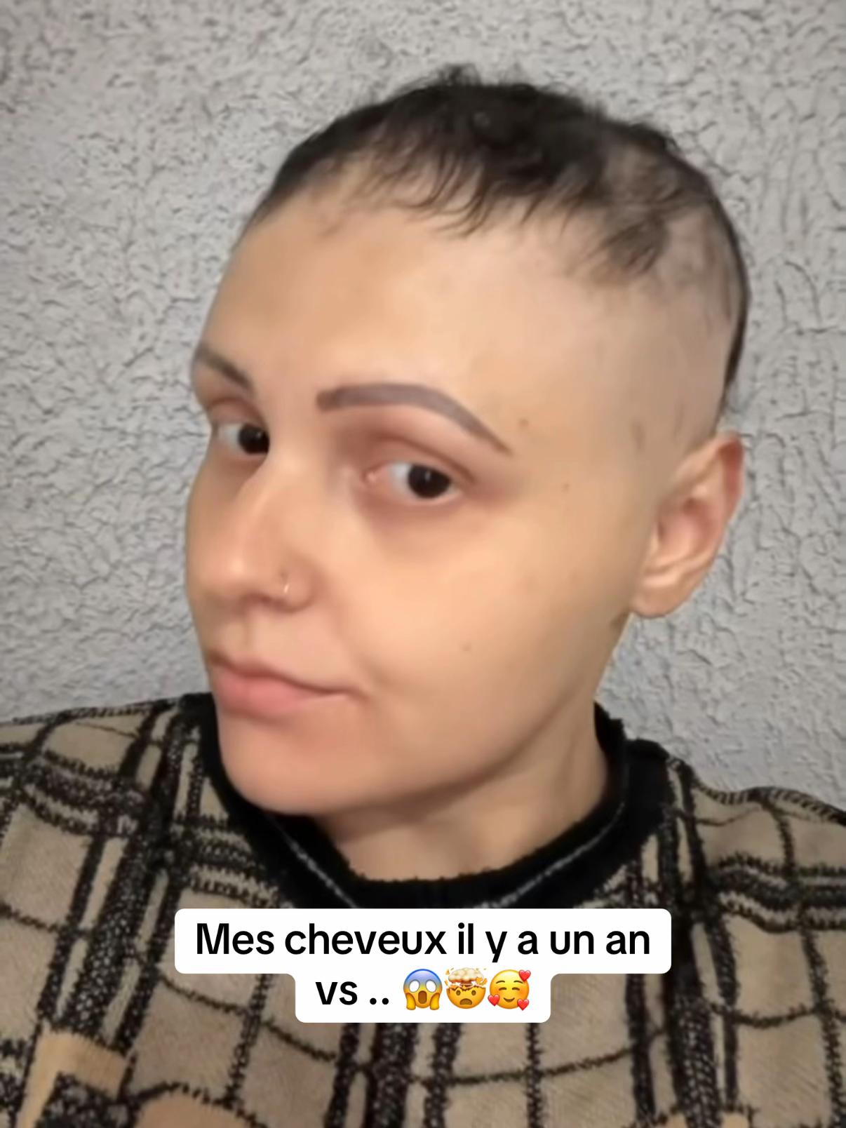 @Lux&rsquo;Hair Growth