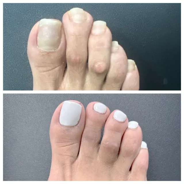 @Deniel Foot and Ankle Center