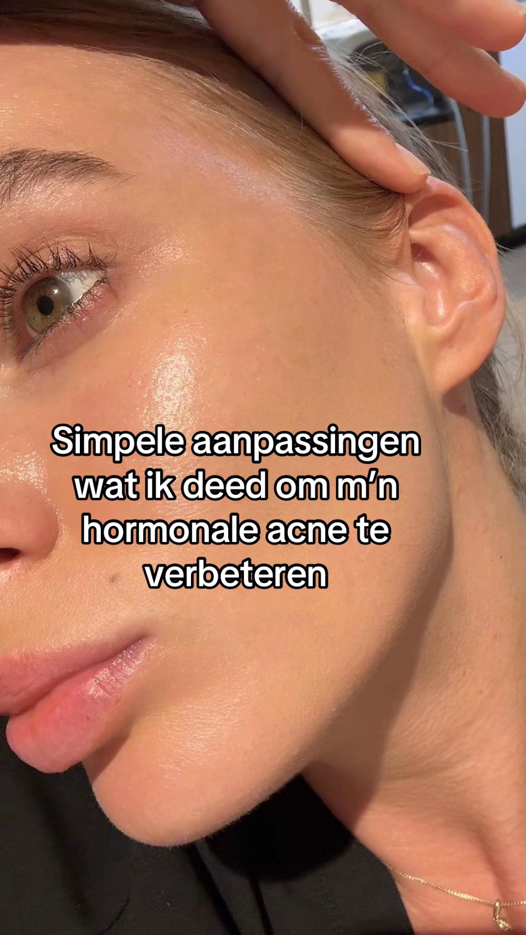 @Skinfixer