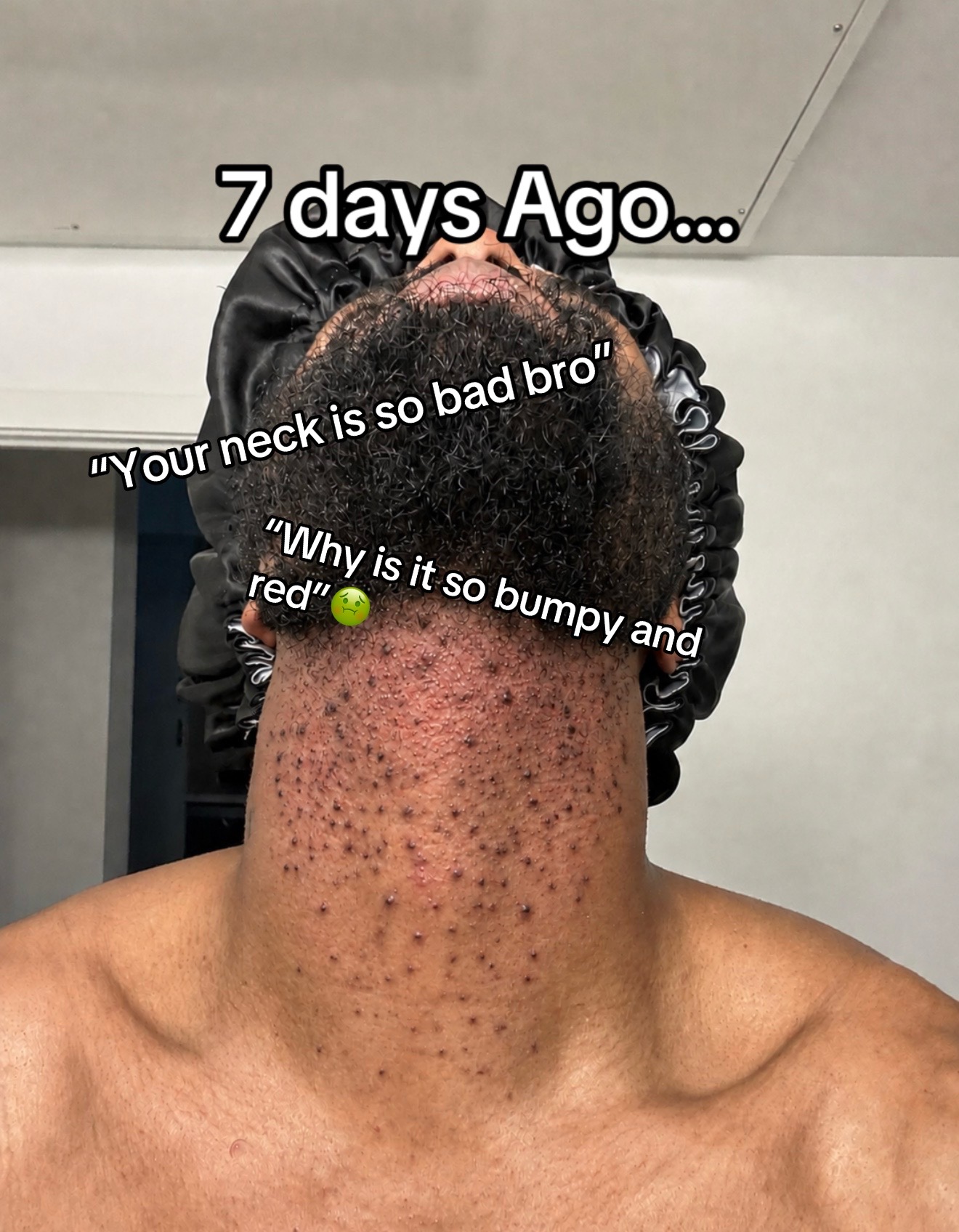 @Imtredarius