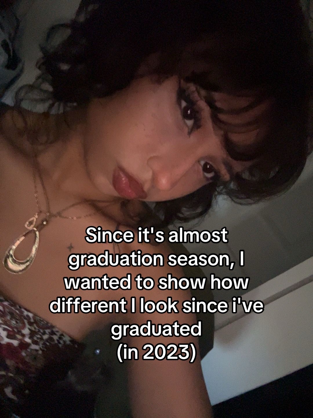 @🦴