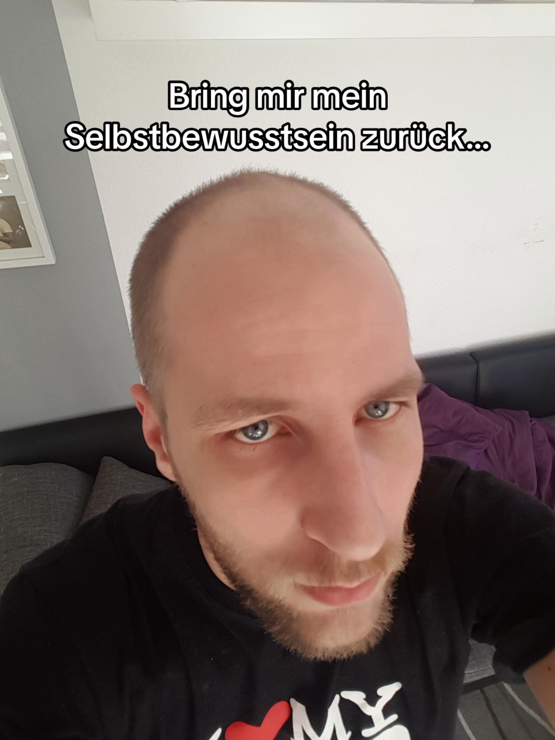 @Mr. Hairtransplant