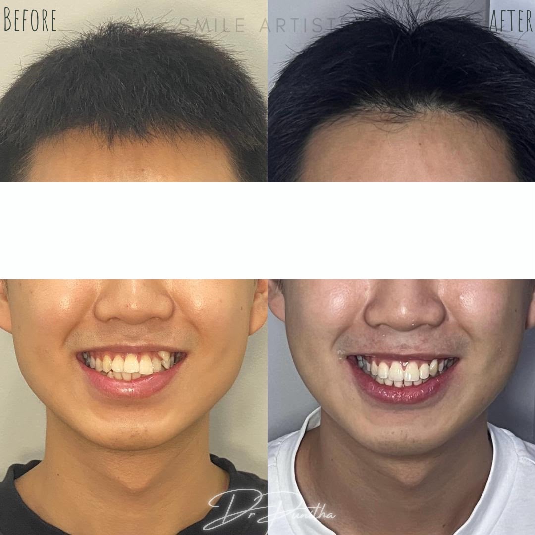 @Smile Artistry Dental Clinic
