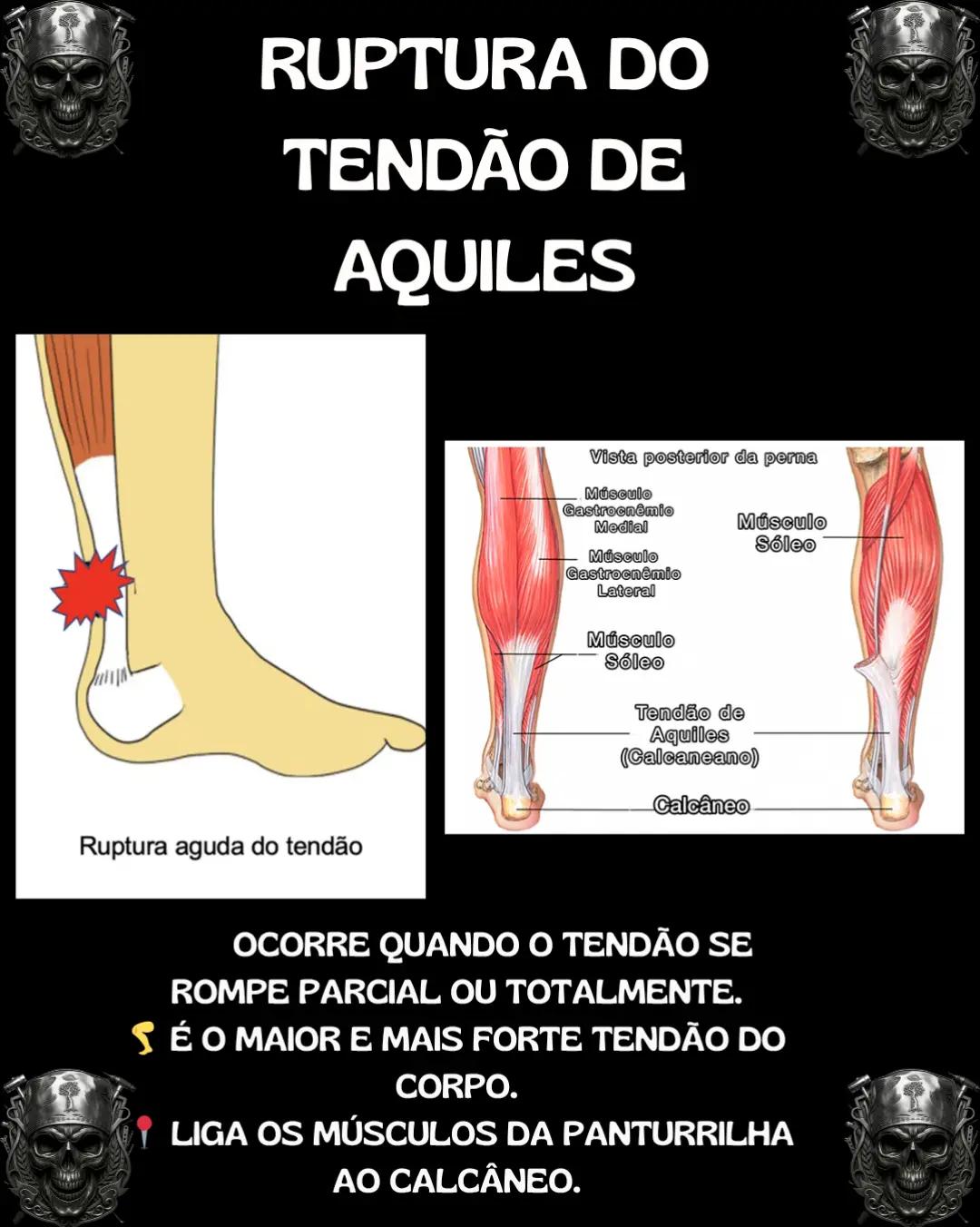 @Traumatologia Maluca