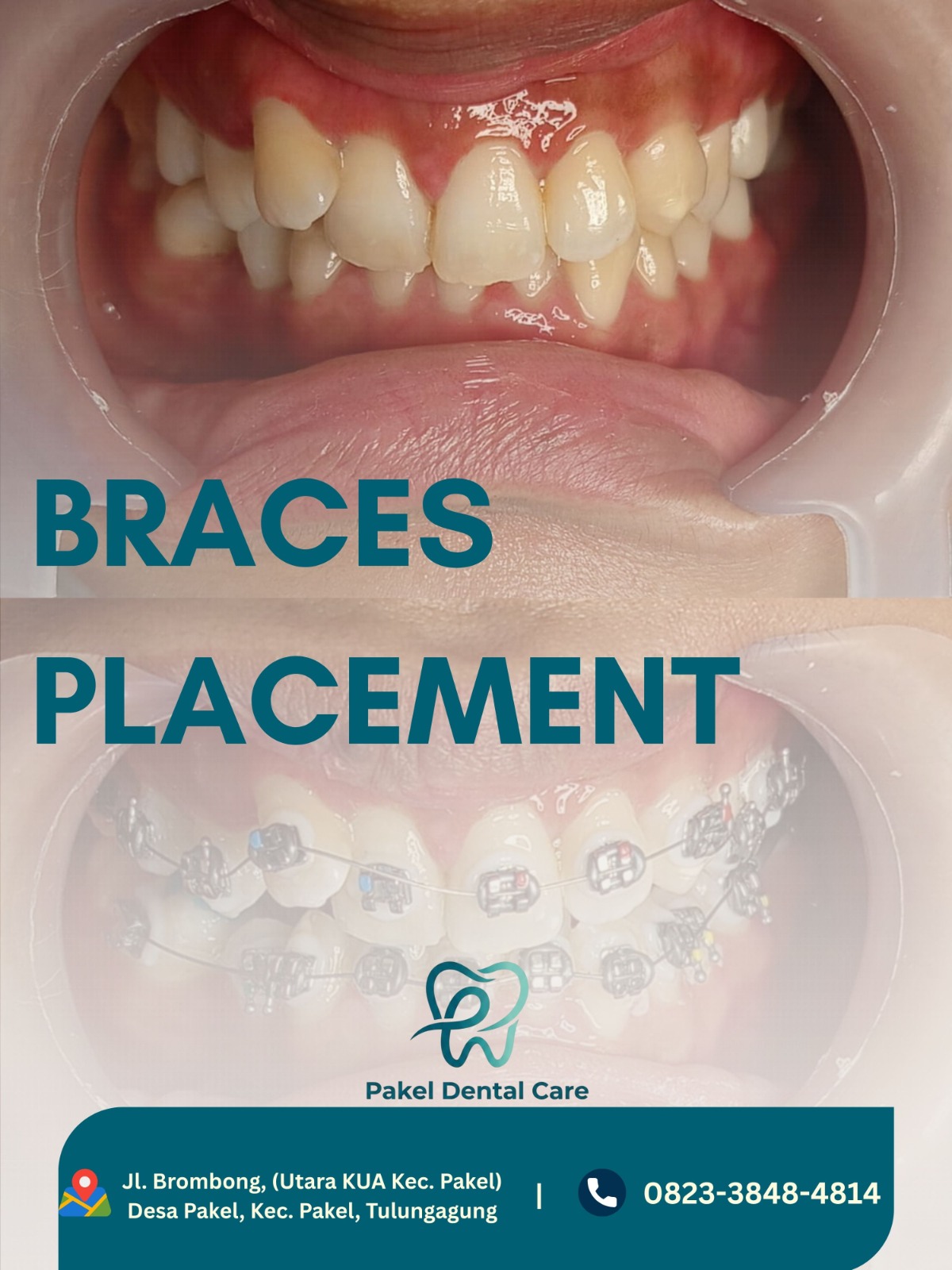 @Pakeldentalcare