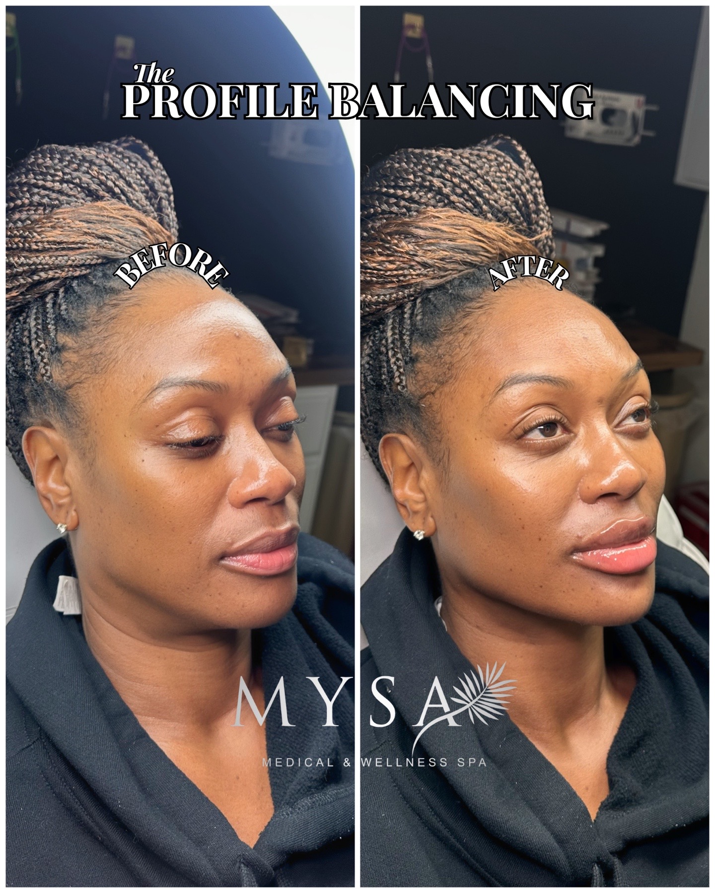 @Mysa Medical & Wellness Spa