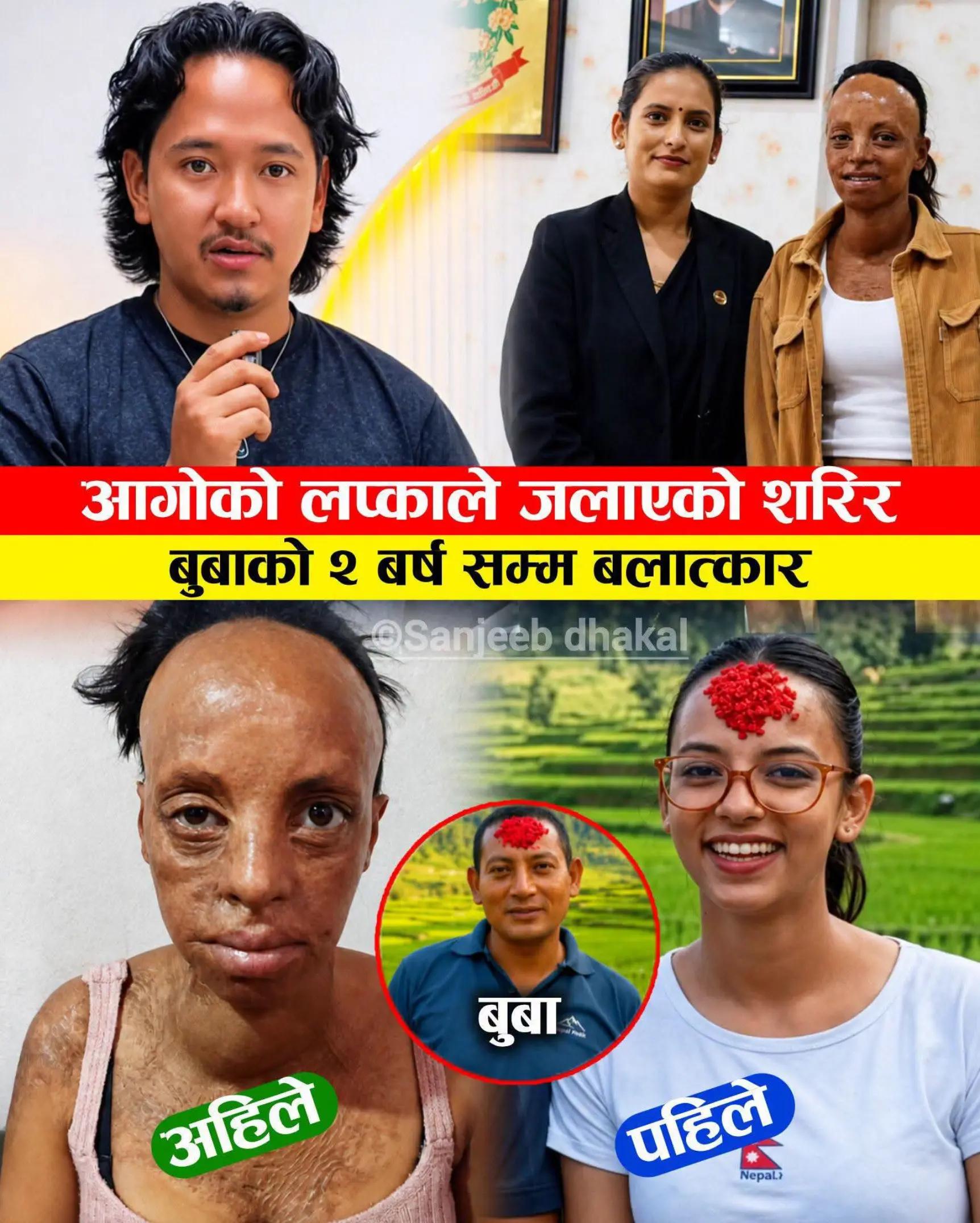 @LifeinNepal